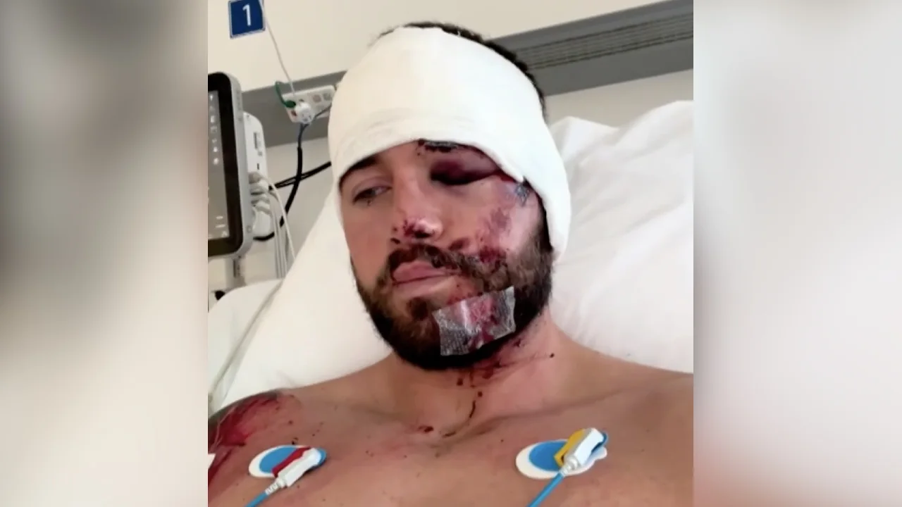 Donny Roelvink gewond nadat hij onder auto terechtkomt: 'Blij dat ik er nog ben'