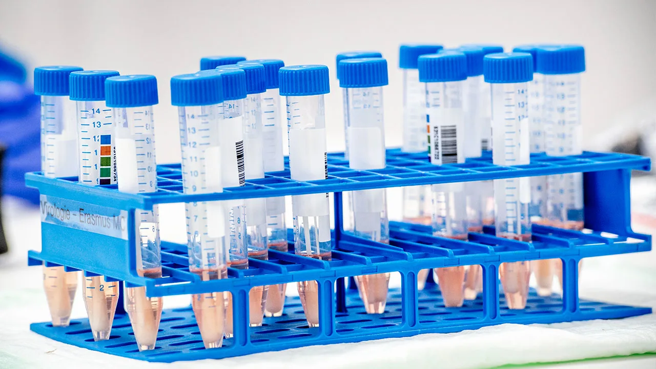 Nieuwe tests wijzen vermoedelijk niet op corona bij NAC