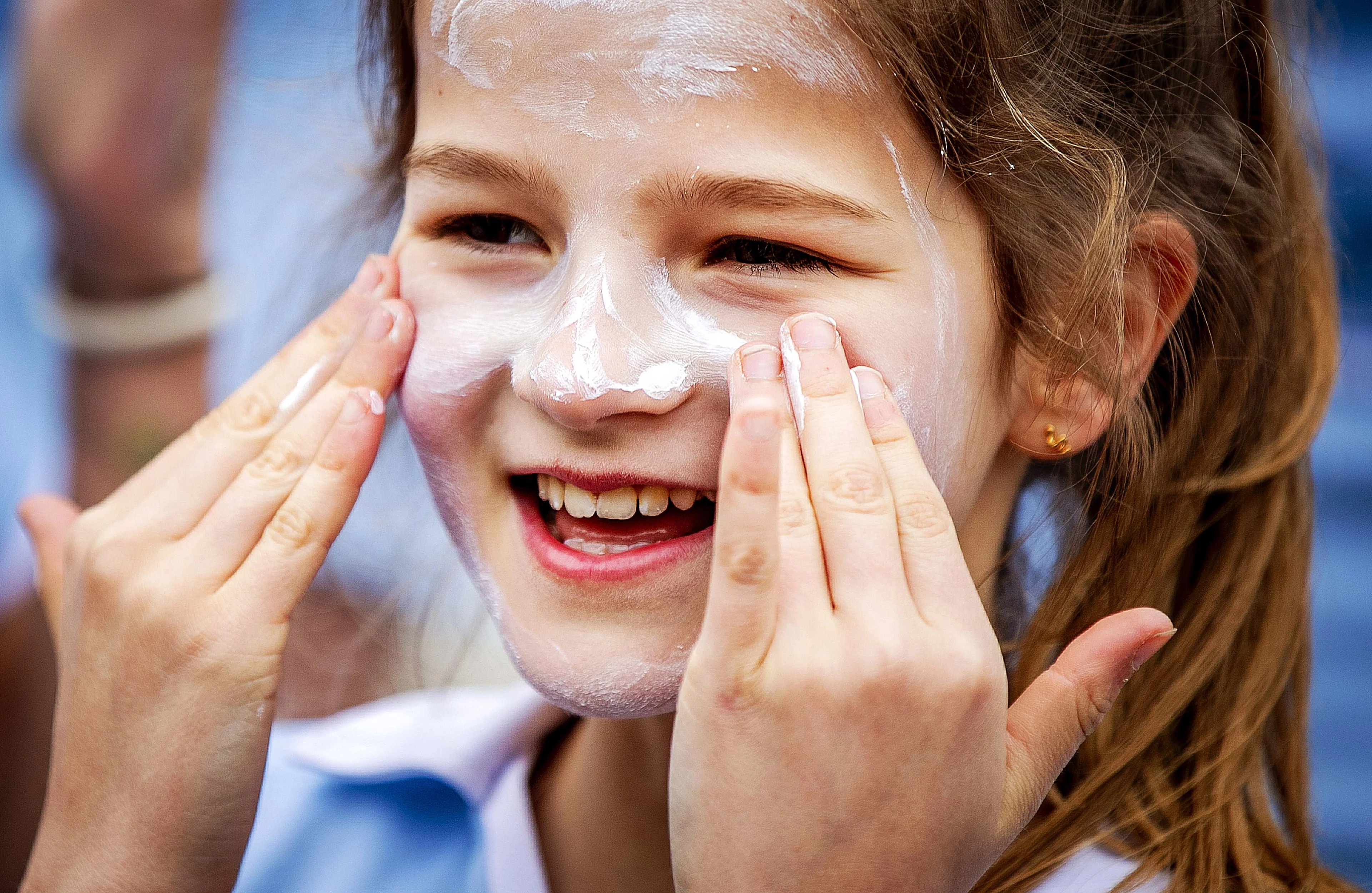 Herkenbaar: deze zonnebrand-irritaties heeft iedereen