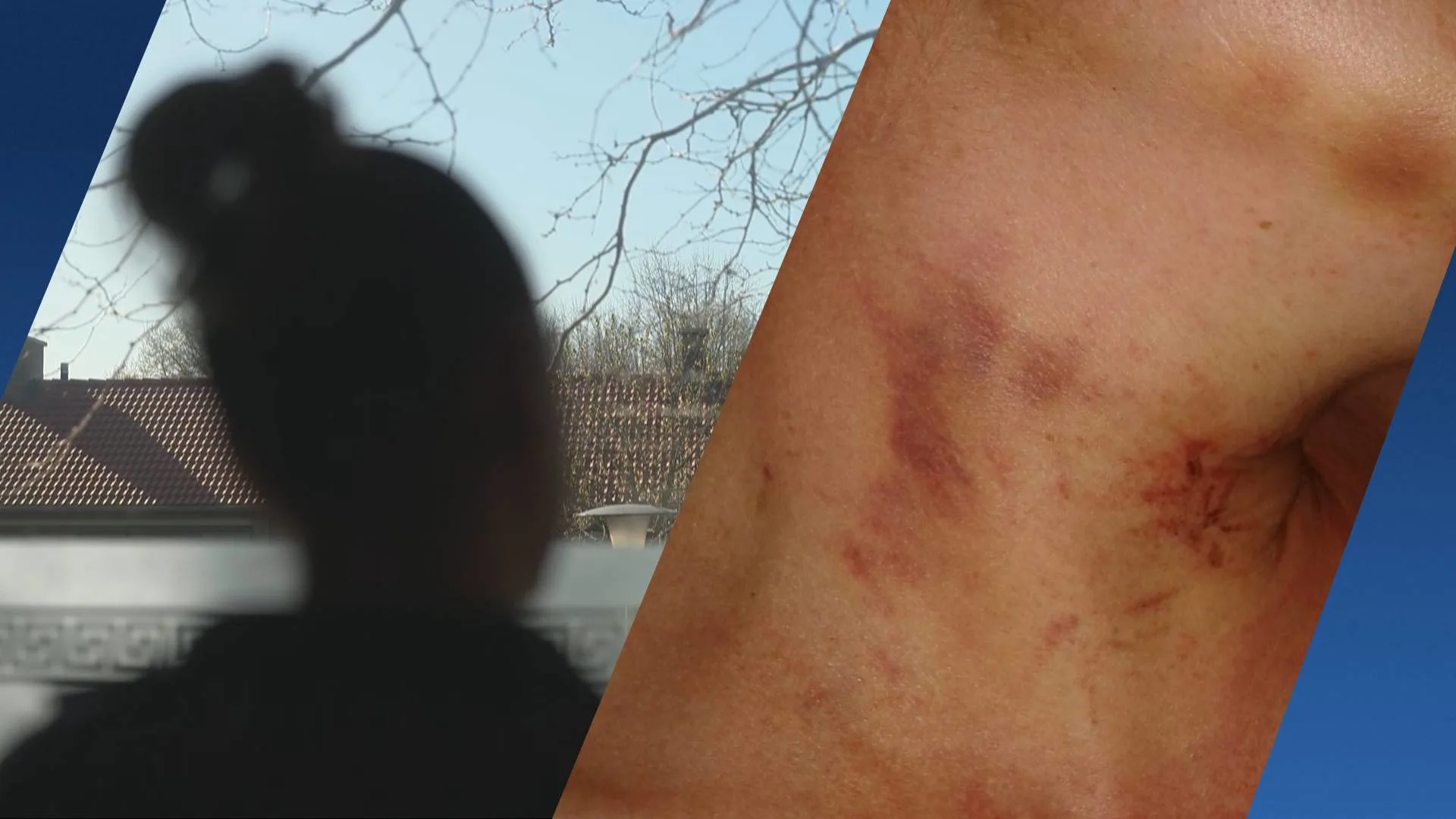 Elke dag minstens één melding van gewurgde vrouw in Nederland