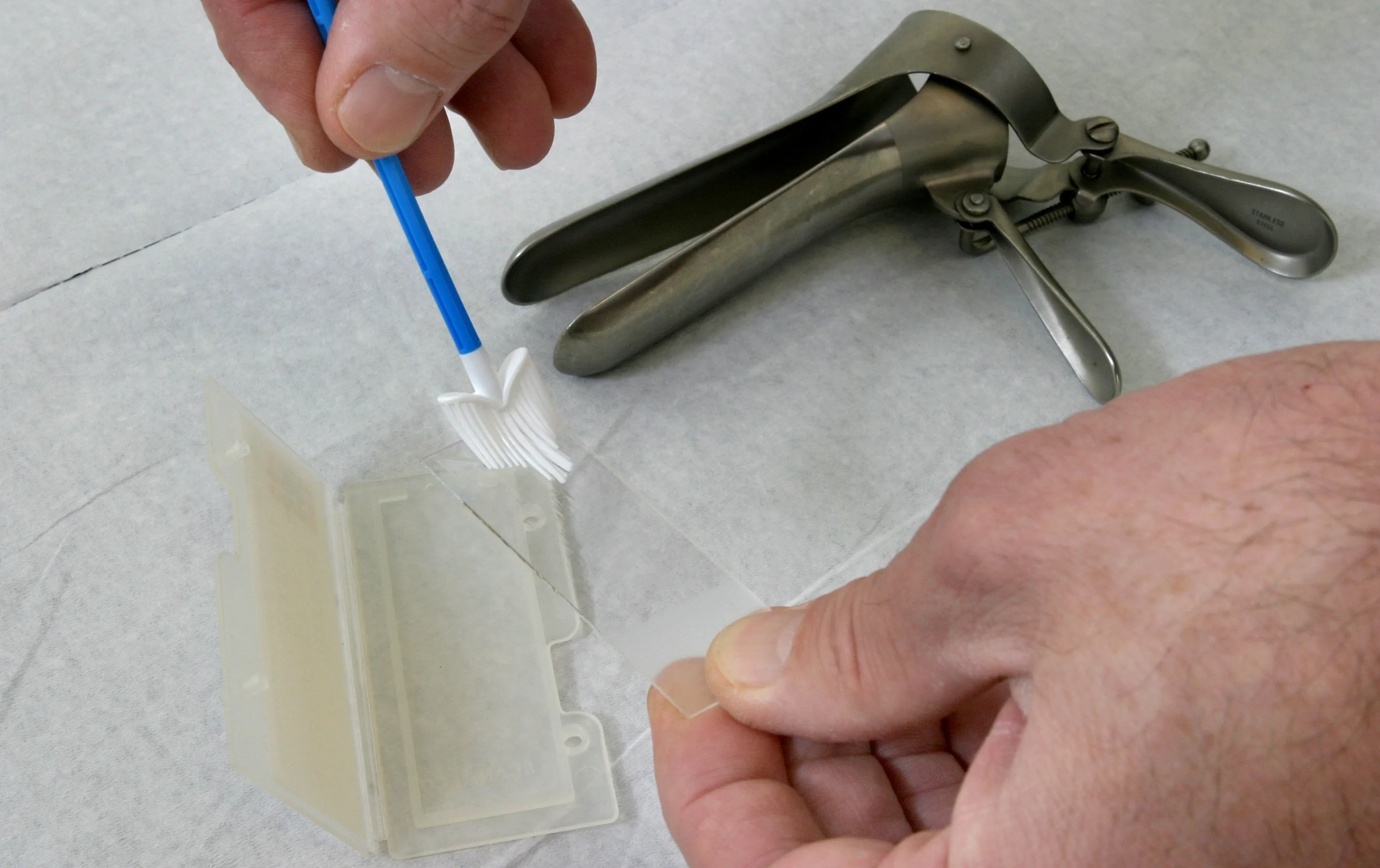 Slechts zes op de tien vrouwen laten uitstrijkje maken en dat moet anders