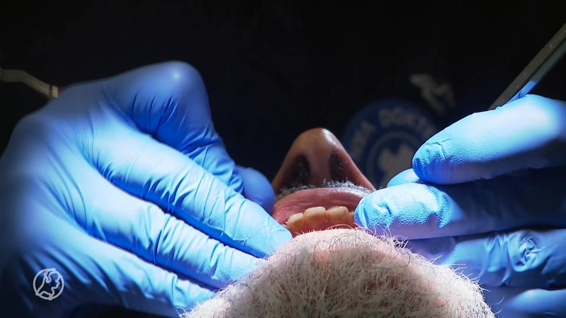 Dit is waarom een tandartsverzekering vaak weggegooid geld is