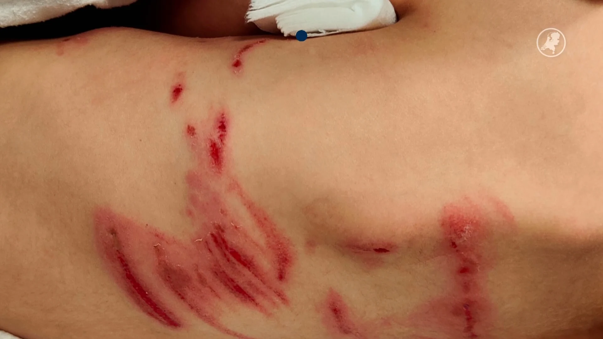 'Kind gebeten en meegesleurd door wolf in bos bij Austerlitz'