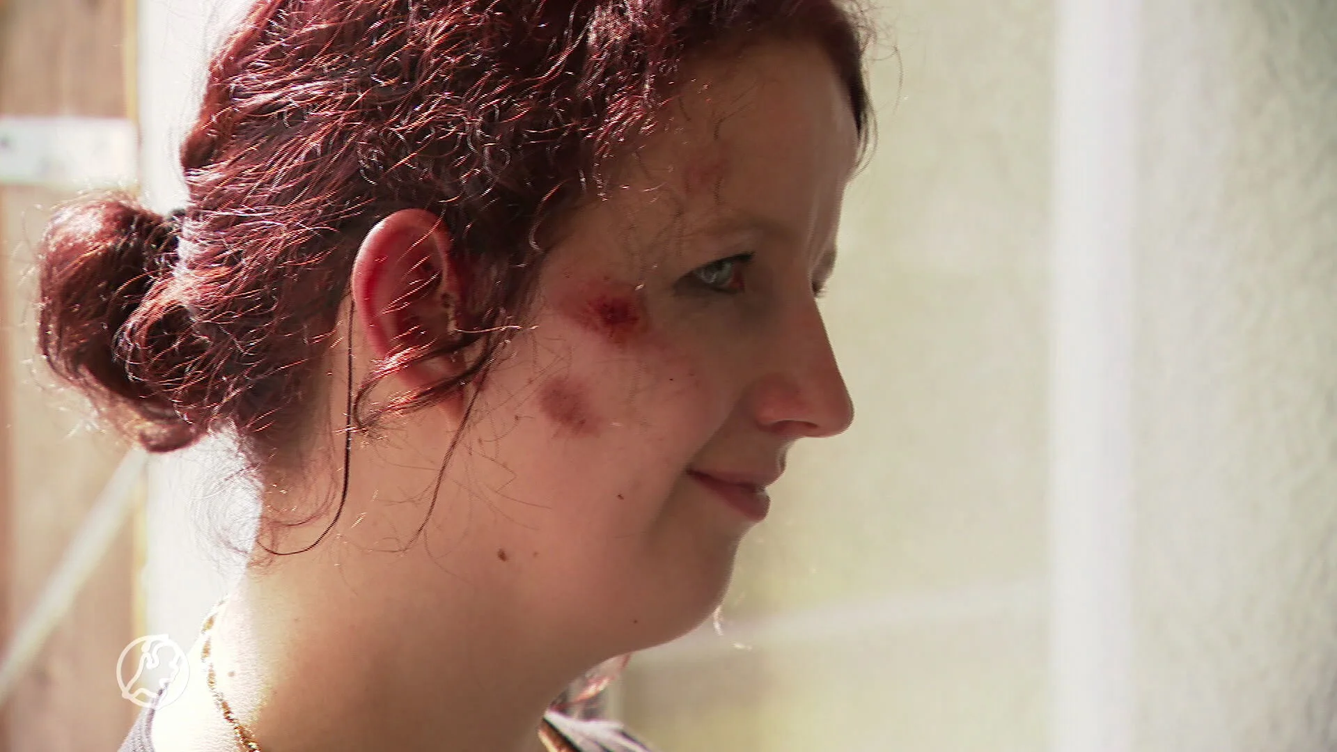 Bianca (24) werd geschept door een auto en onder het bloed achtergelaten