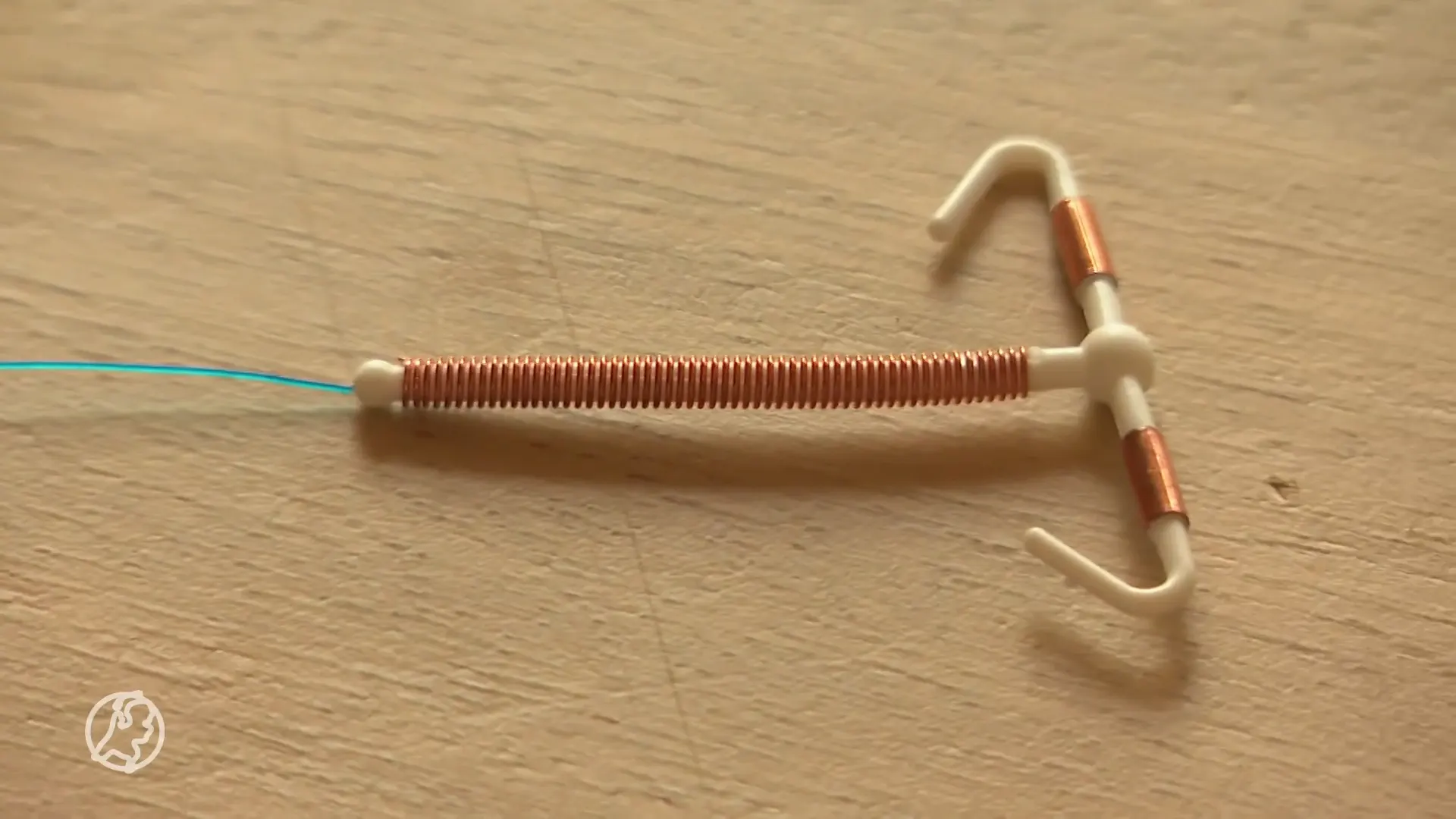 Toch verdoving bij zetten spiraal? 'Ik was lijkbleek en kon helemaal niks meer'