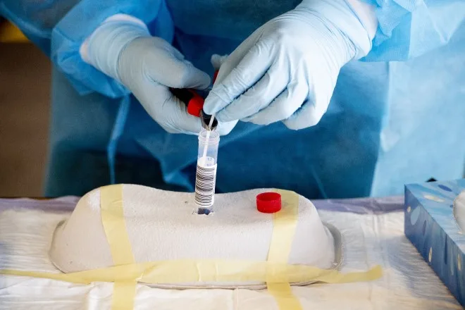 Aantal nieuwe coronabesmettingen gestegen tot boven weekgemiddelde