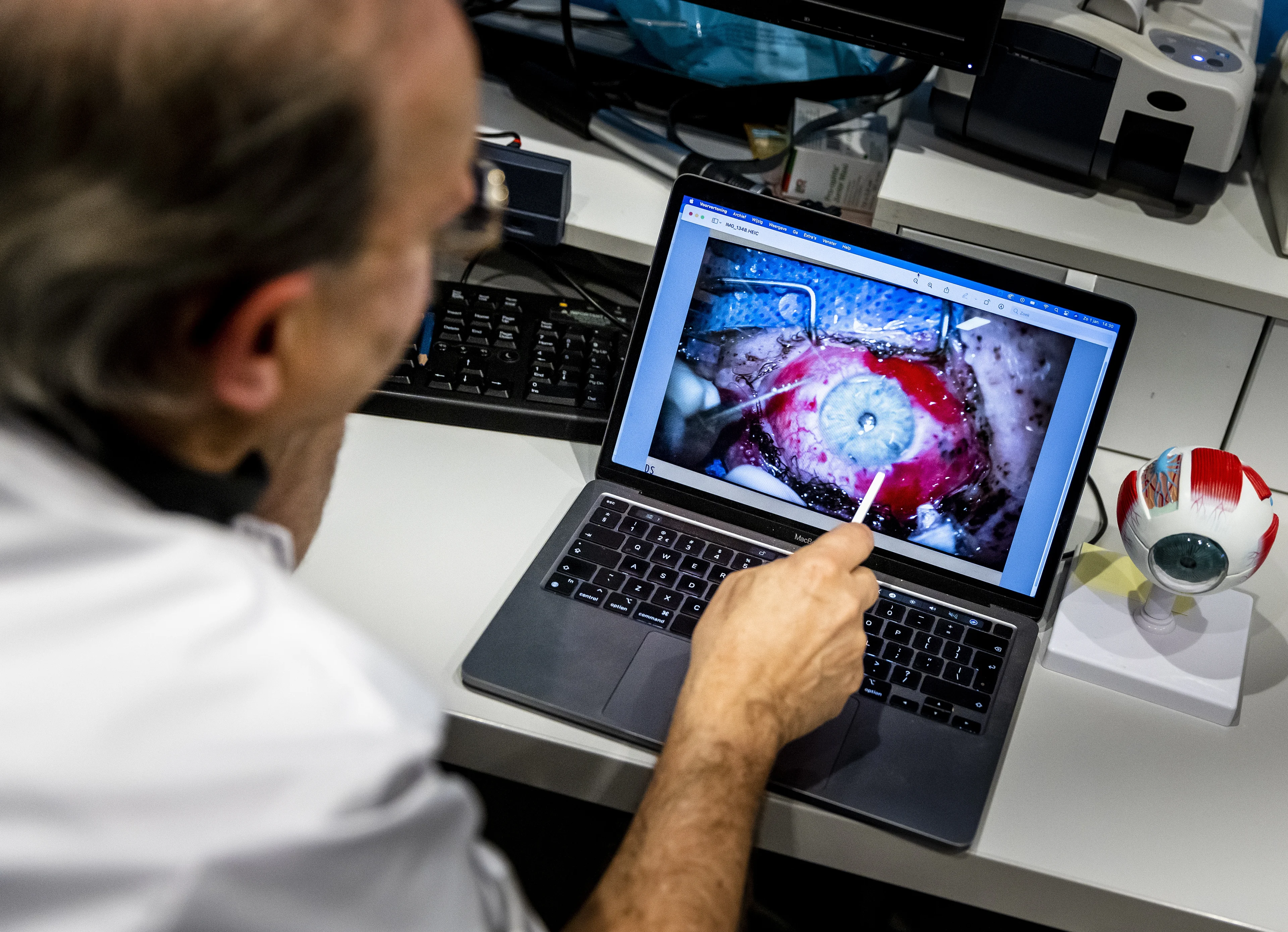 Aantal vuurwerkslachtoffers met oogletsel loopt op: 'Een horrornacht'