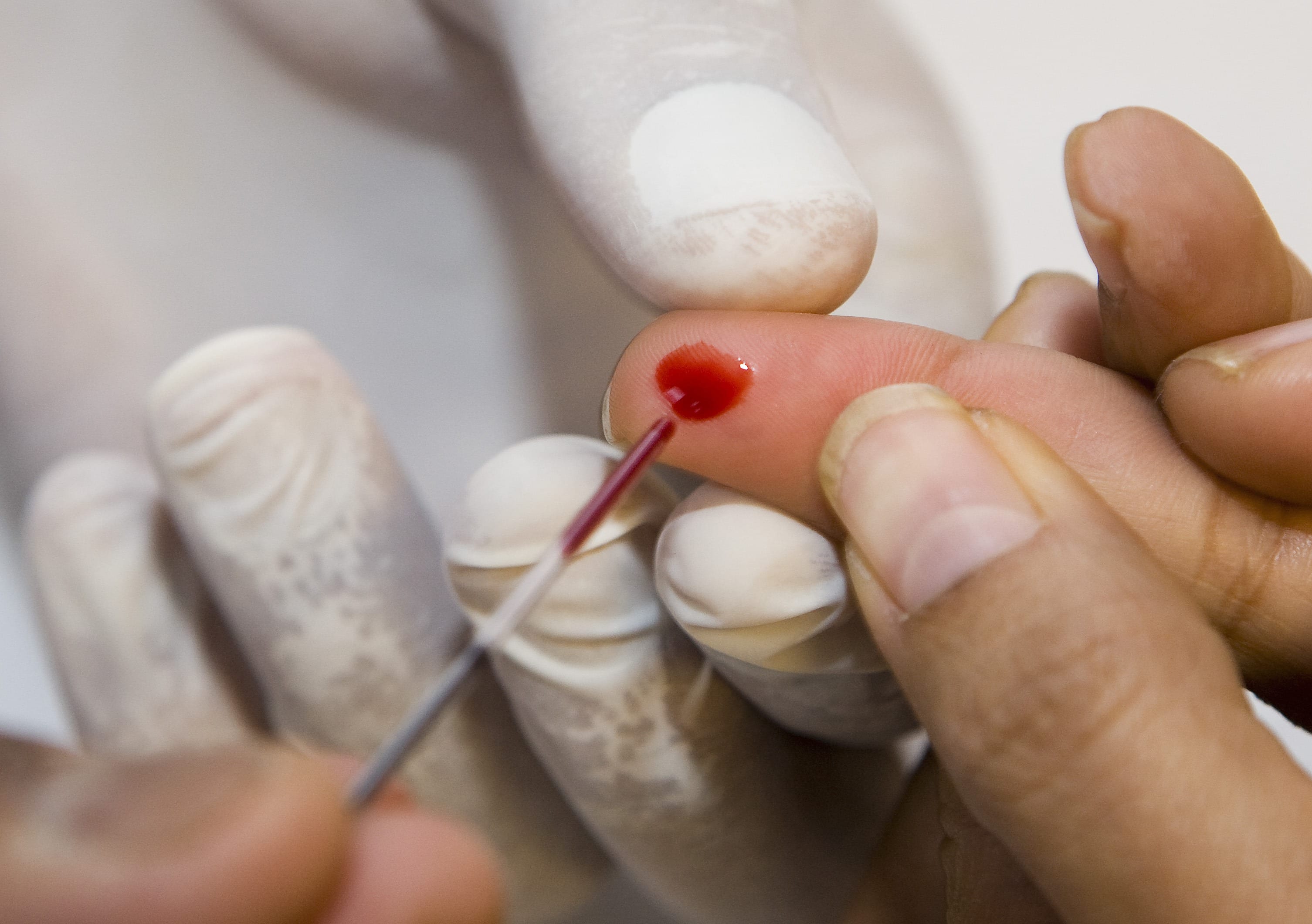 PFAS bij iedereen in het bloed: 'Effect hangt af van gezondheidssituatie'