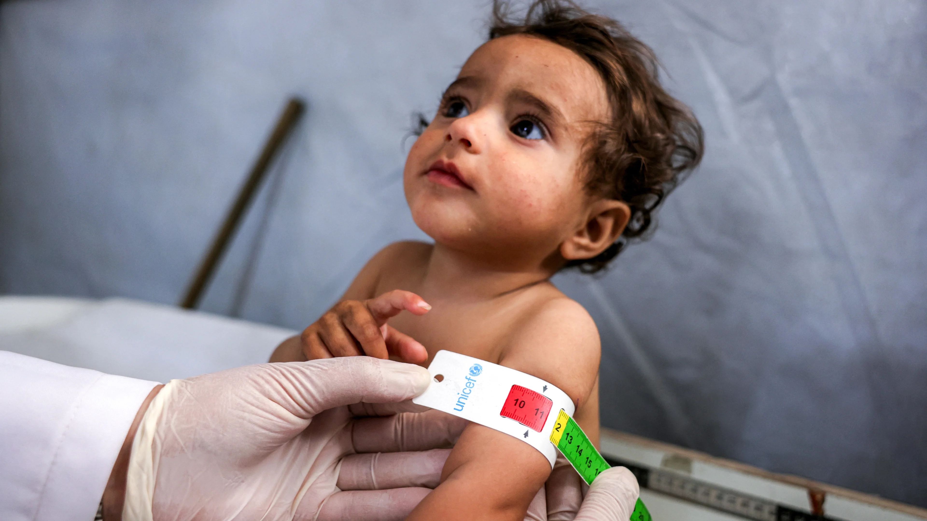 Kabinet gaat toch zieke kinderen uit Gaza naar Nederland halen