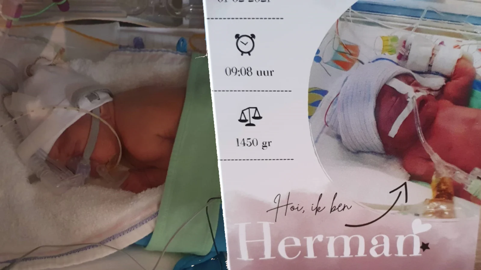 Jessica bevalt bij tandarts na ongemerkte zwangerschap: 'Herman was er met twee minuten'