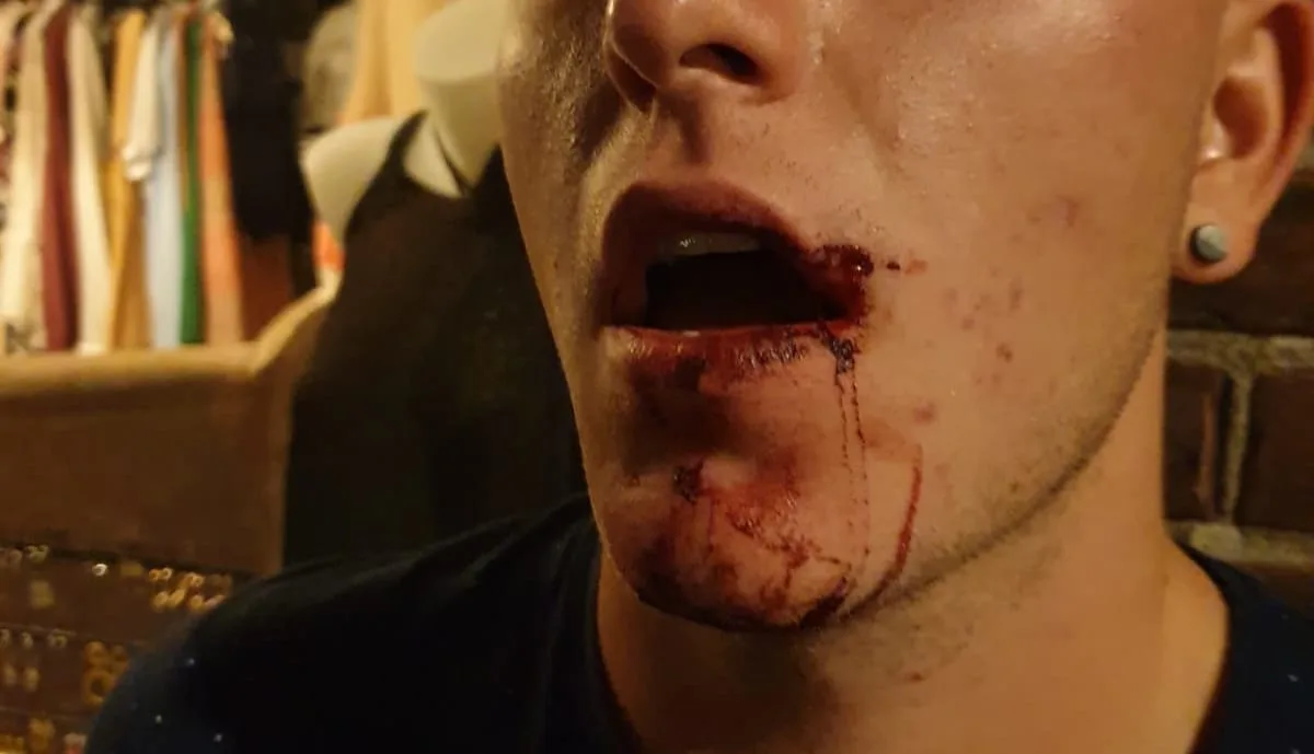 Twee homo's in elkaar geslagen in centrum Hengelo: 'Waar halen jullie het gore lef vandaan'