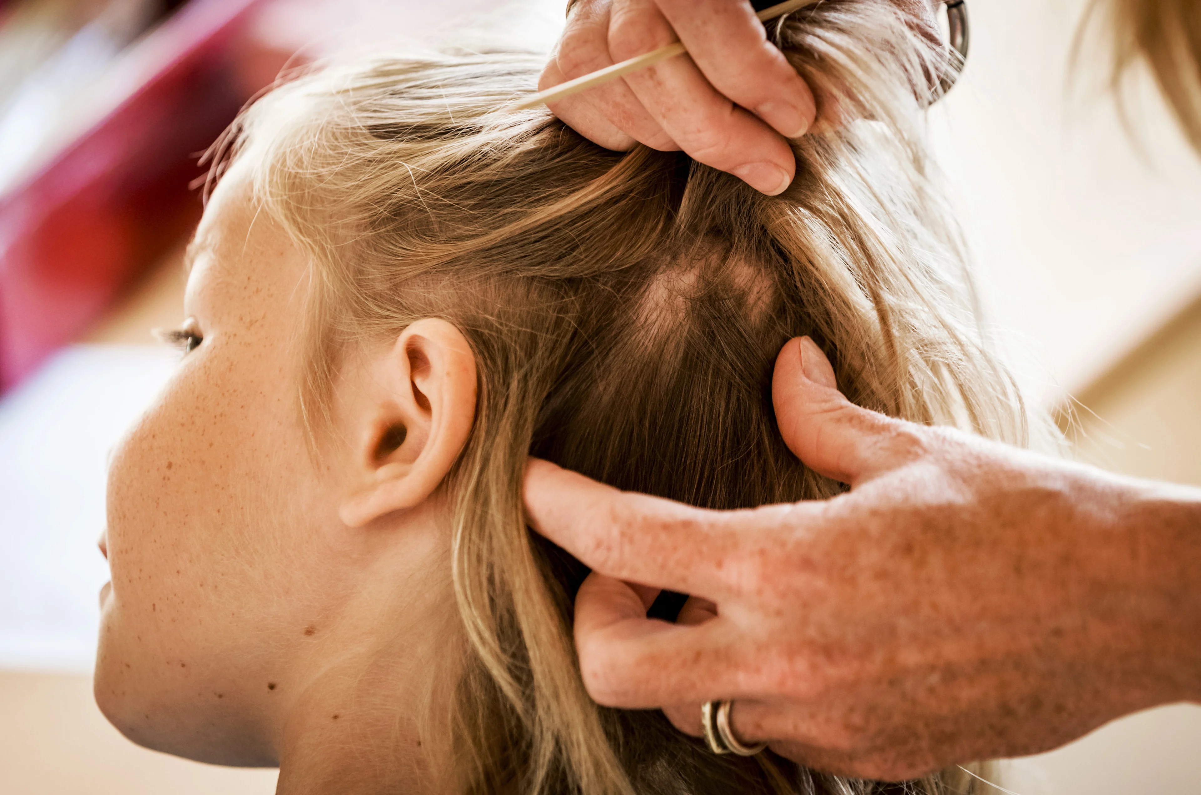 Coronapatiënt uit Amsterdam was vorige week luizenmoeder