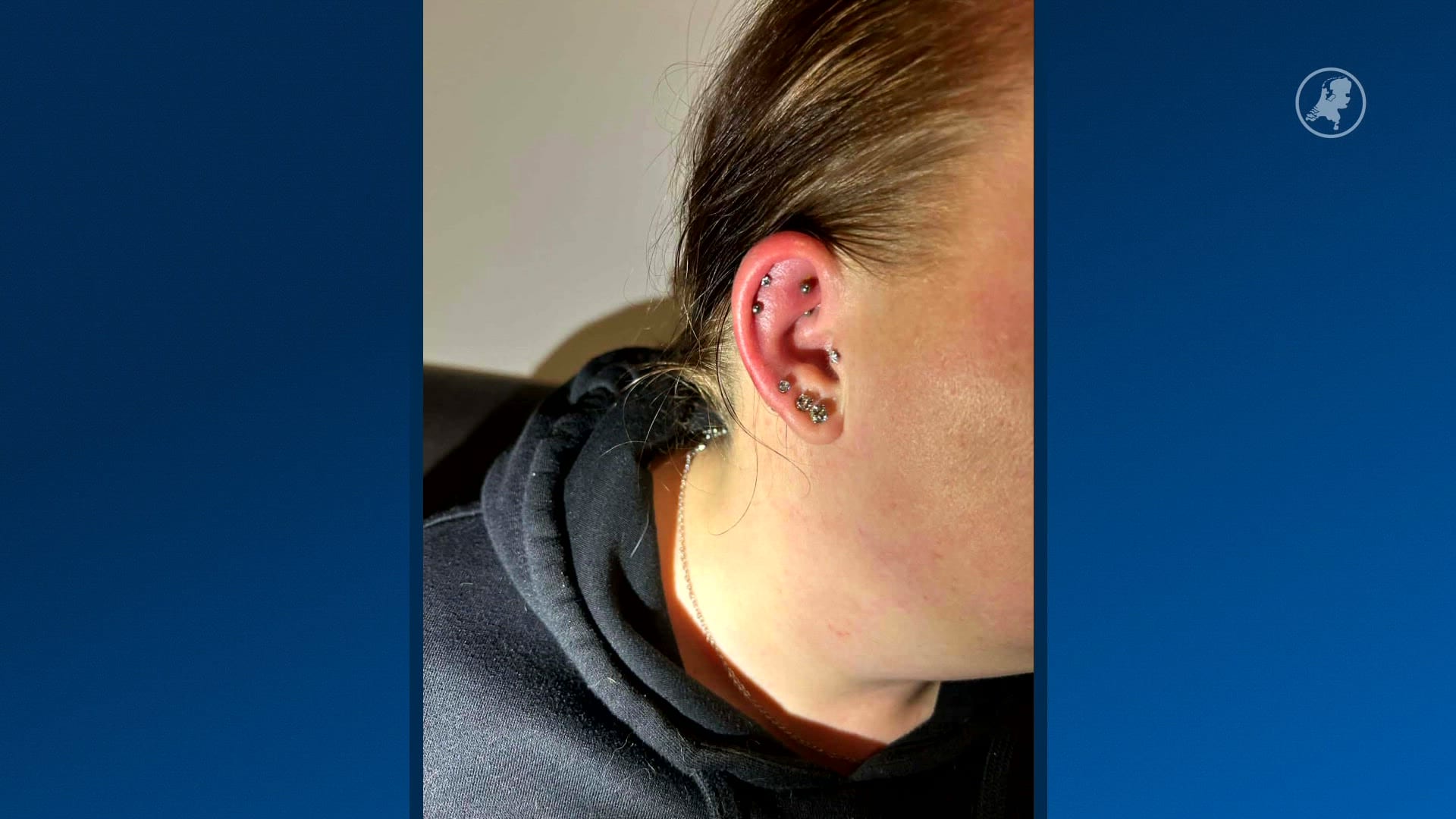 Jolanda werd ziek na gebruik nazorgspray voor piercings