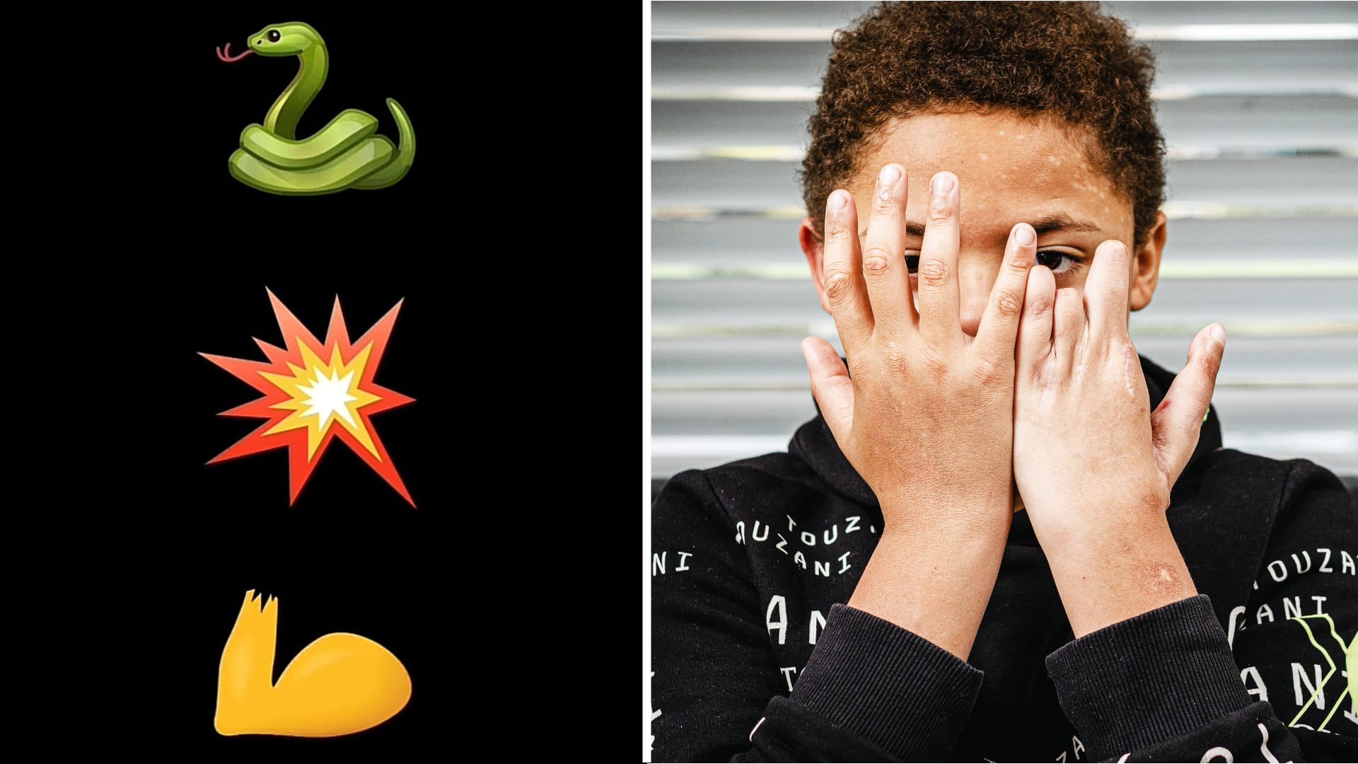 Chirurgen waarschuwen jongeren via emoji's voor gevaren Cobra-vuurwerk
