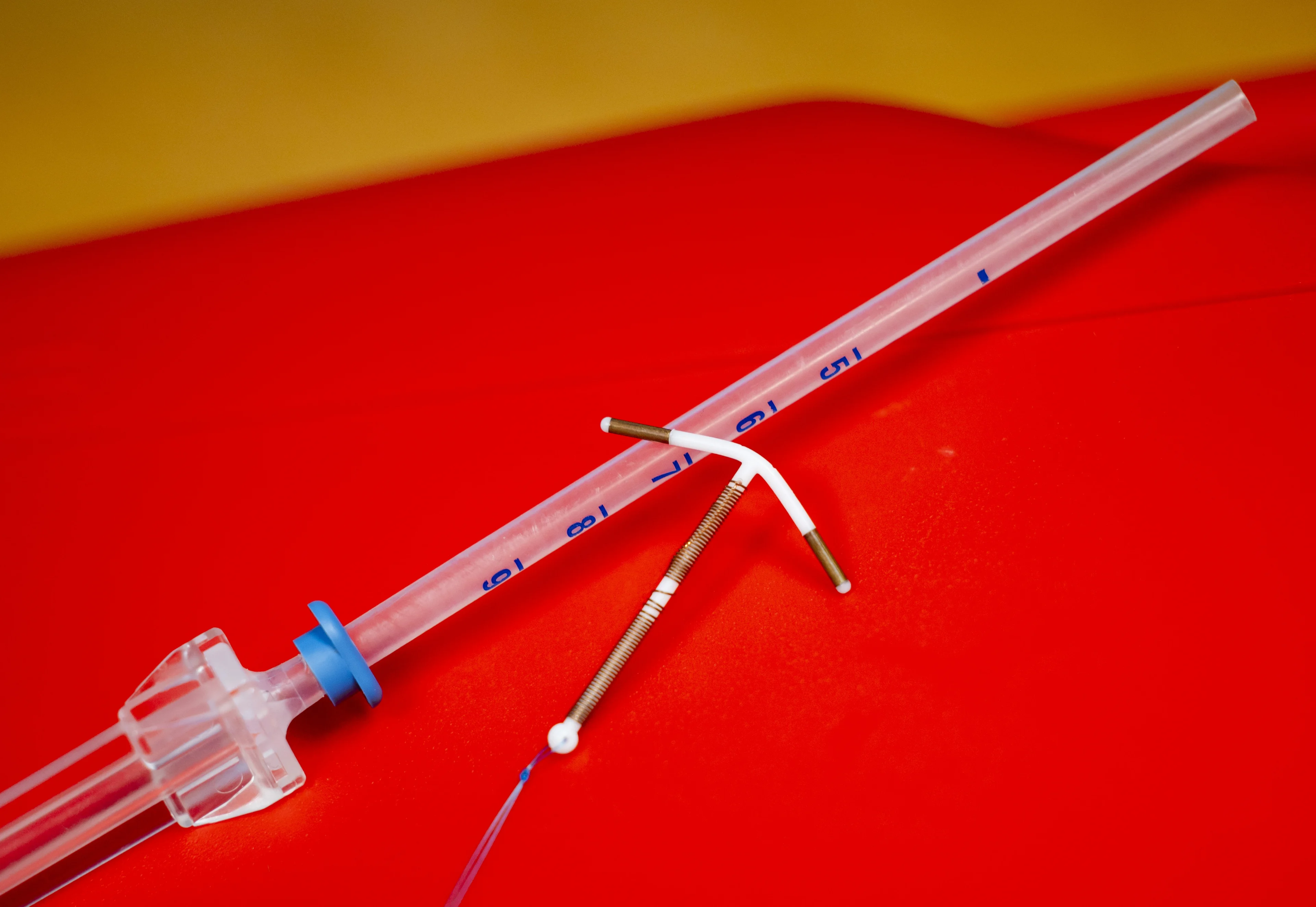 Tientallen vrouwen toch zwanger ondanks gebruik koperspiraal