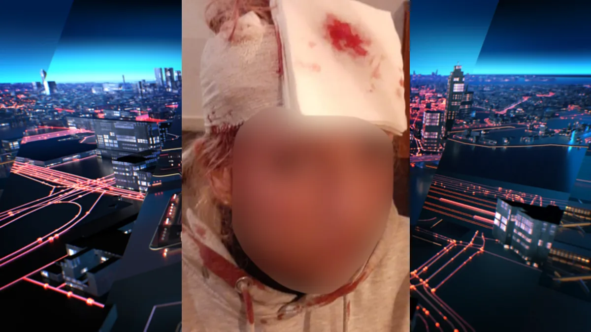 Ashley (16) krijgt enorme steen tegen haar hoofd tijdens busrit