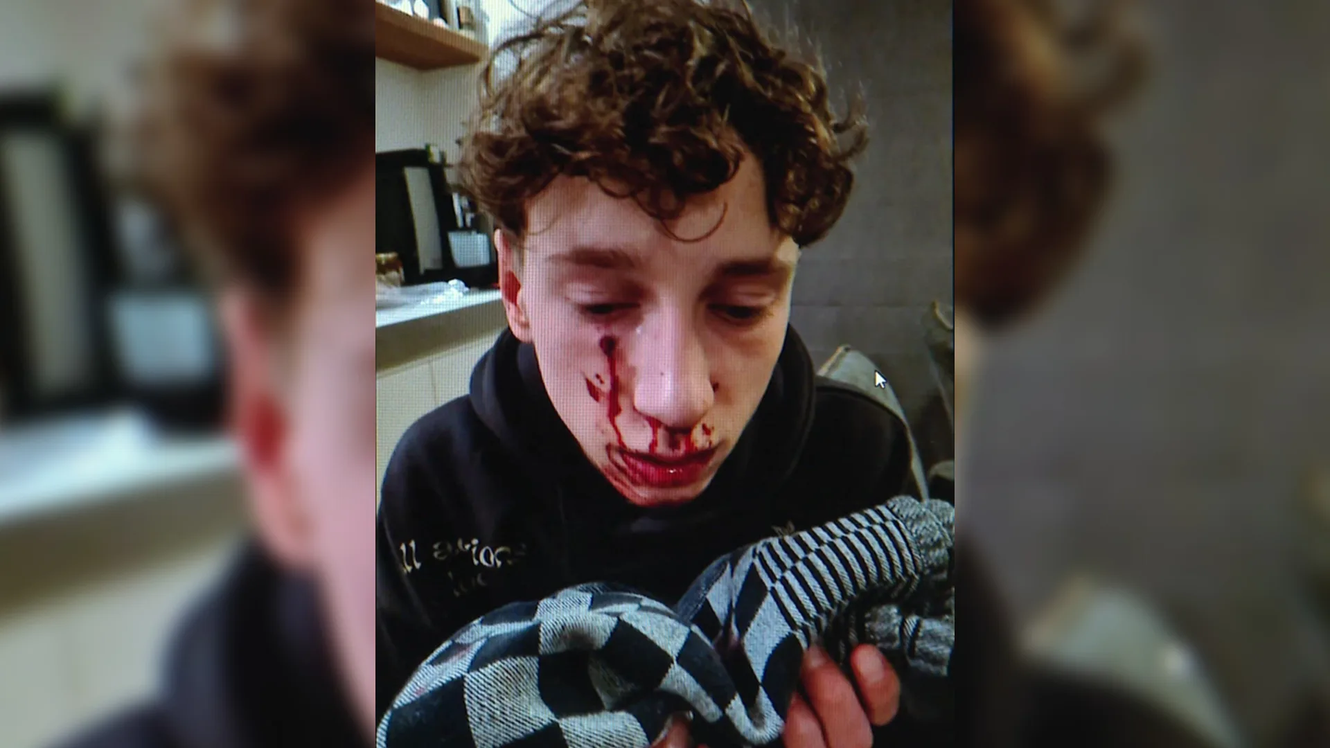 Loet (16) beschoten in gezicht, kogel komt nét onder oog: 'Had er niet meer kunnen zijn'