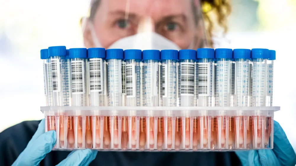 Weer minder positieve coronatests gemeld, daling in ziekenhuizen gaat langzamer