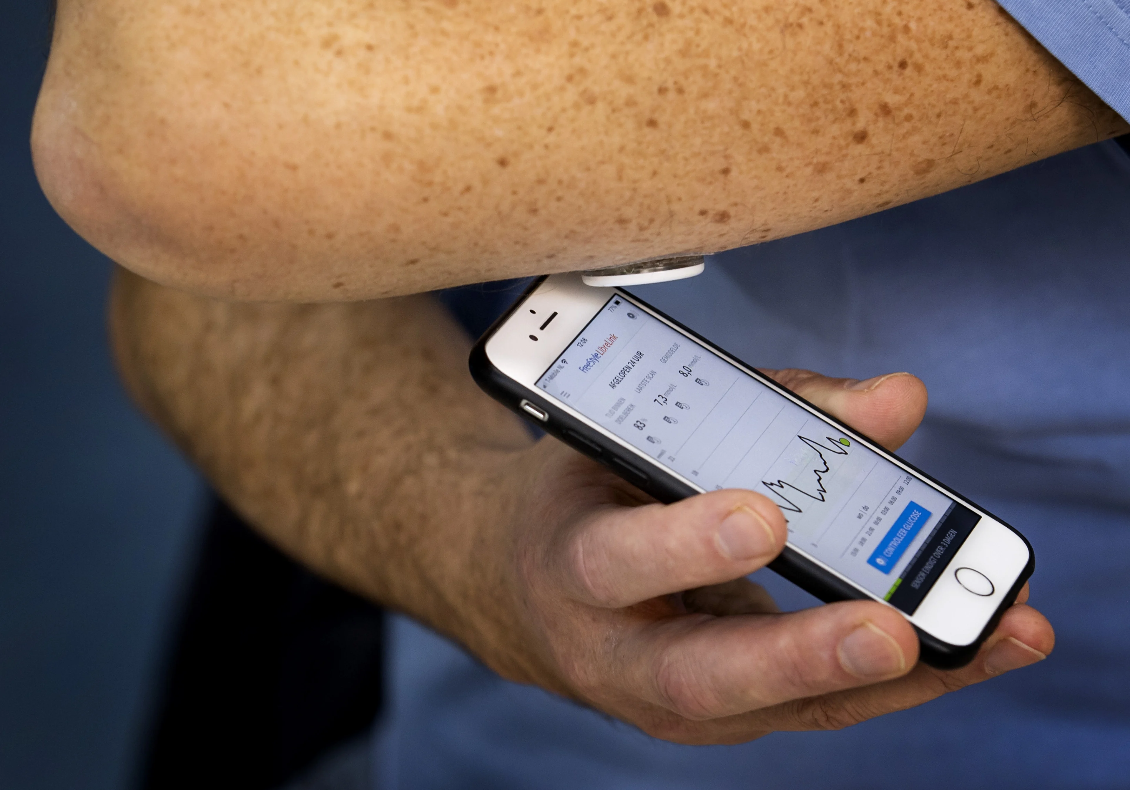 Schokkend: 1 op 6 mensen met prediabetes krijgt hartinfarct of beroerte