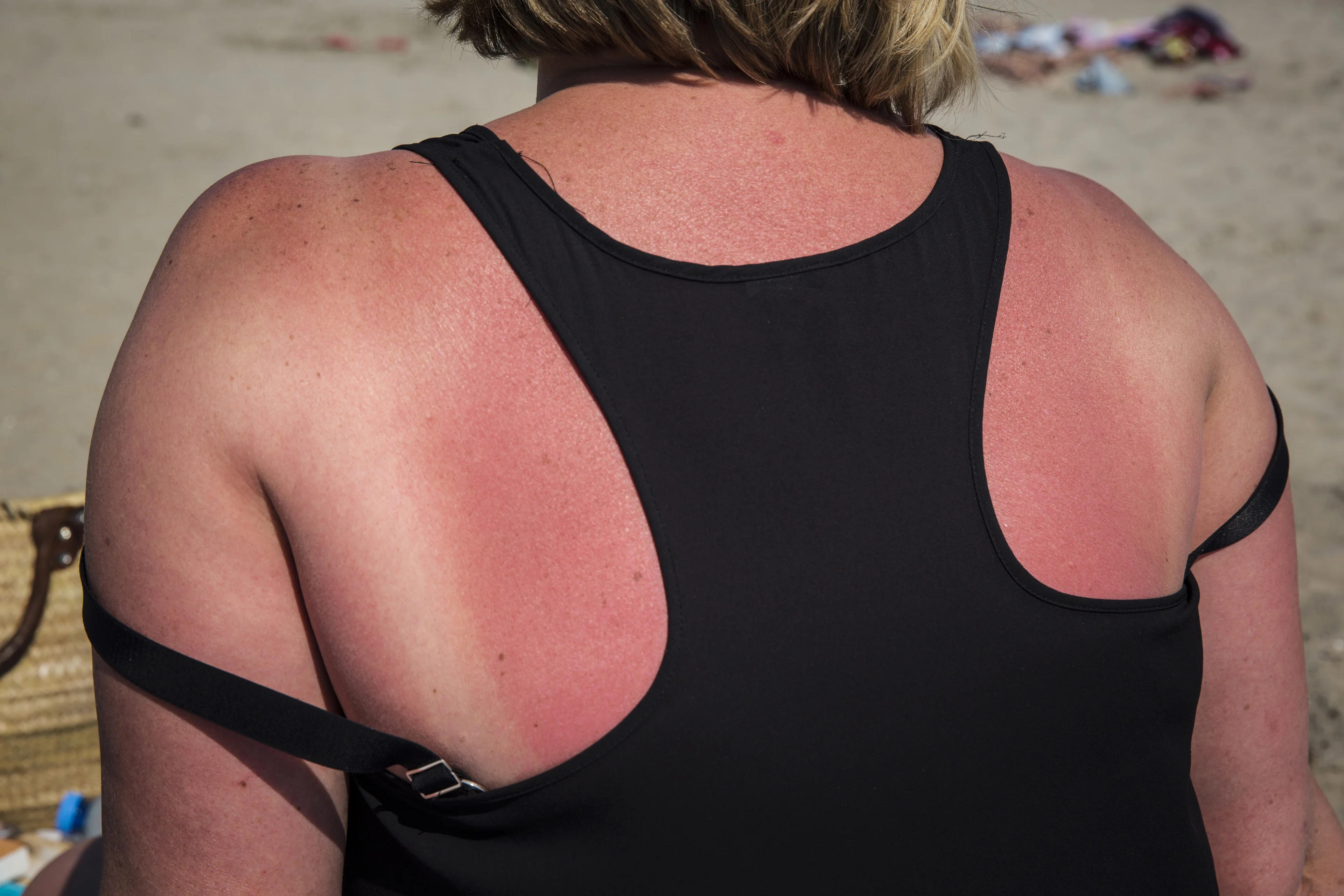 Insmeren? Deze 5 hardnekkige mythes over de zon kloppen niet