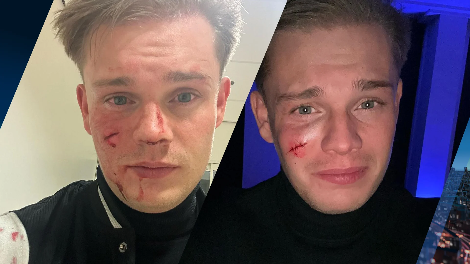 Neergestoken Dennis Schouten doet ook aangifte van bedreiging en smaad