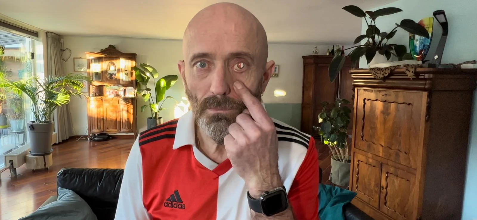 Paul heeft twee kunstogen met het logo van Feyenoord: 'Ik ben een fan in hart, nieren en oog'