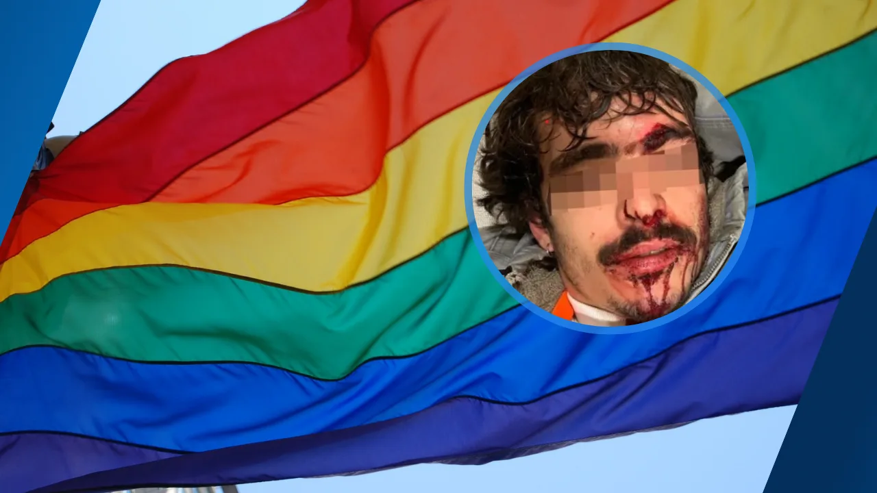 Band aangevallen bij queer space Venlo, zoon Sunny Bergman bewusteloos geslagen