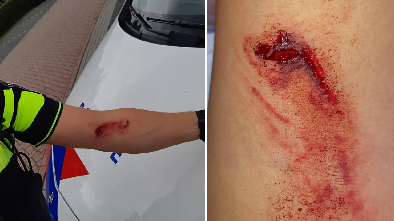 Man (32) neemt flinke hap uit arm van agent in Almelo