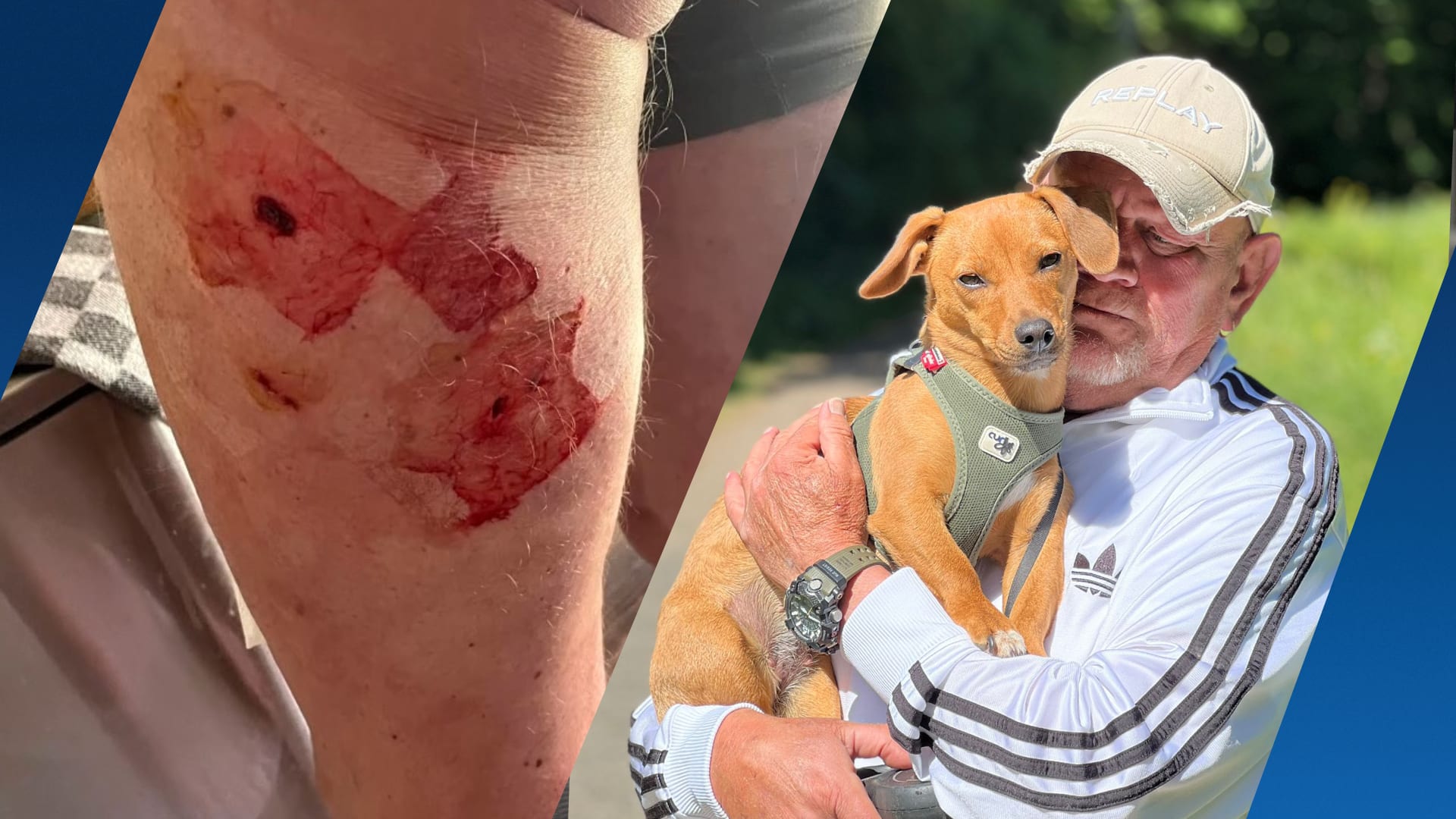 Hond valt Eric aan in bos: 'Het voelde alsof die maar één doel had: mij pakken'