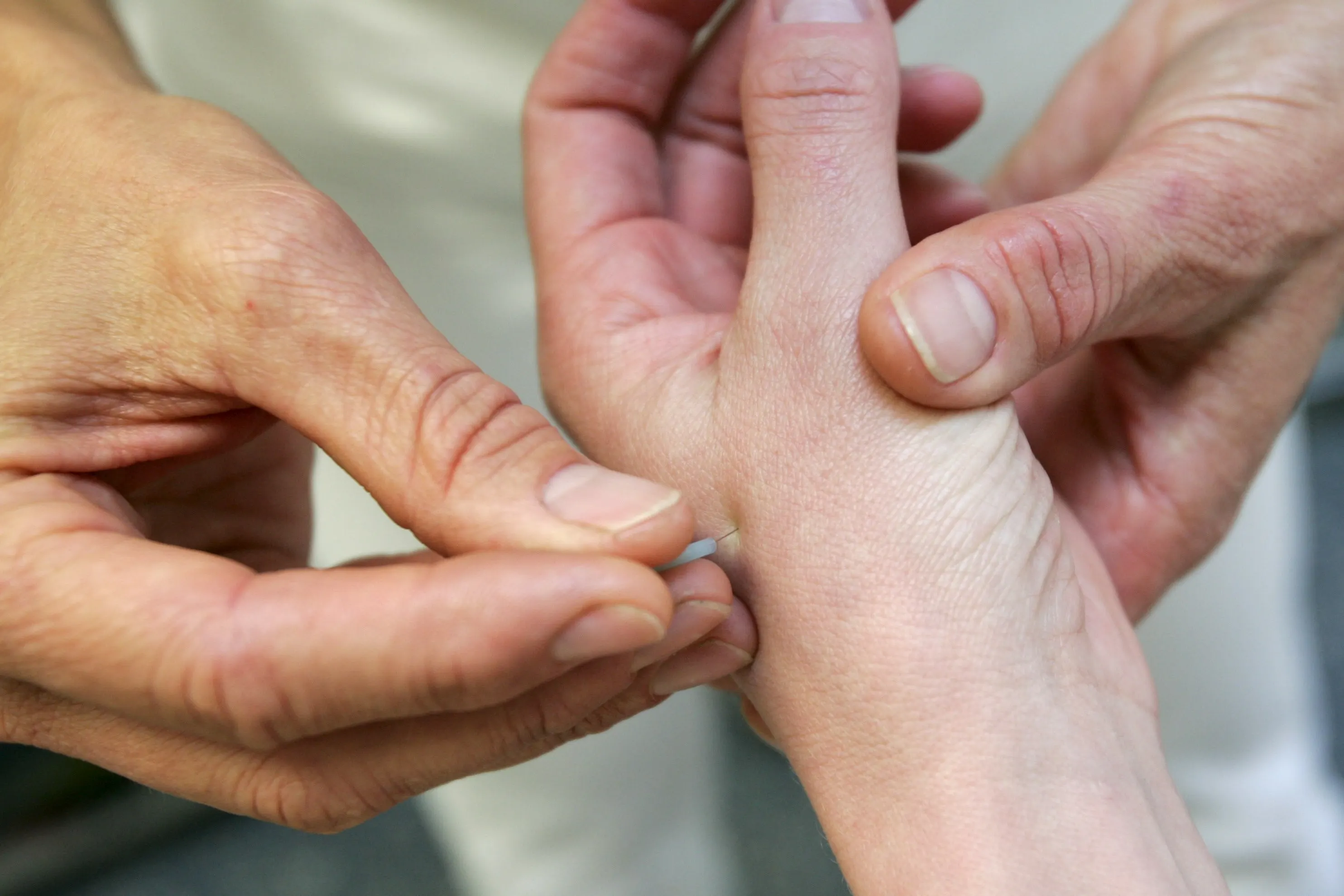 Familie waarschuwt voor omstreden arts na dood Nederlandse man in Spanje