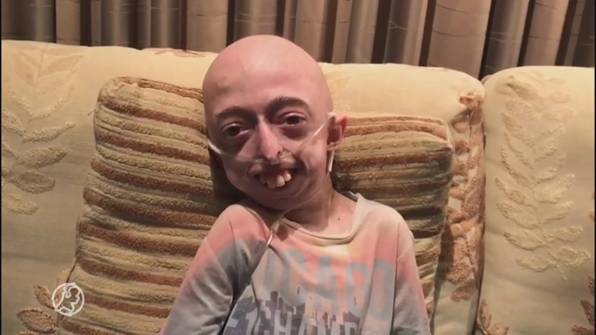 Progeriapatiënt Bjorn blaast tegen alle verwachtingen in 21 kaarsjes uit