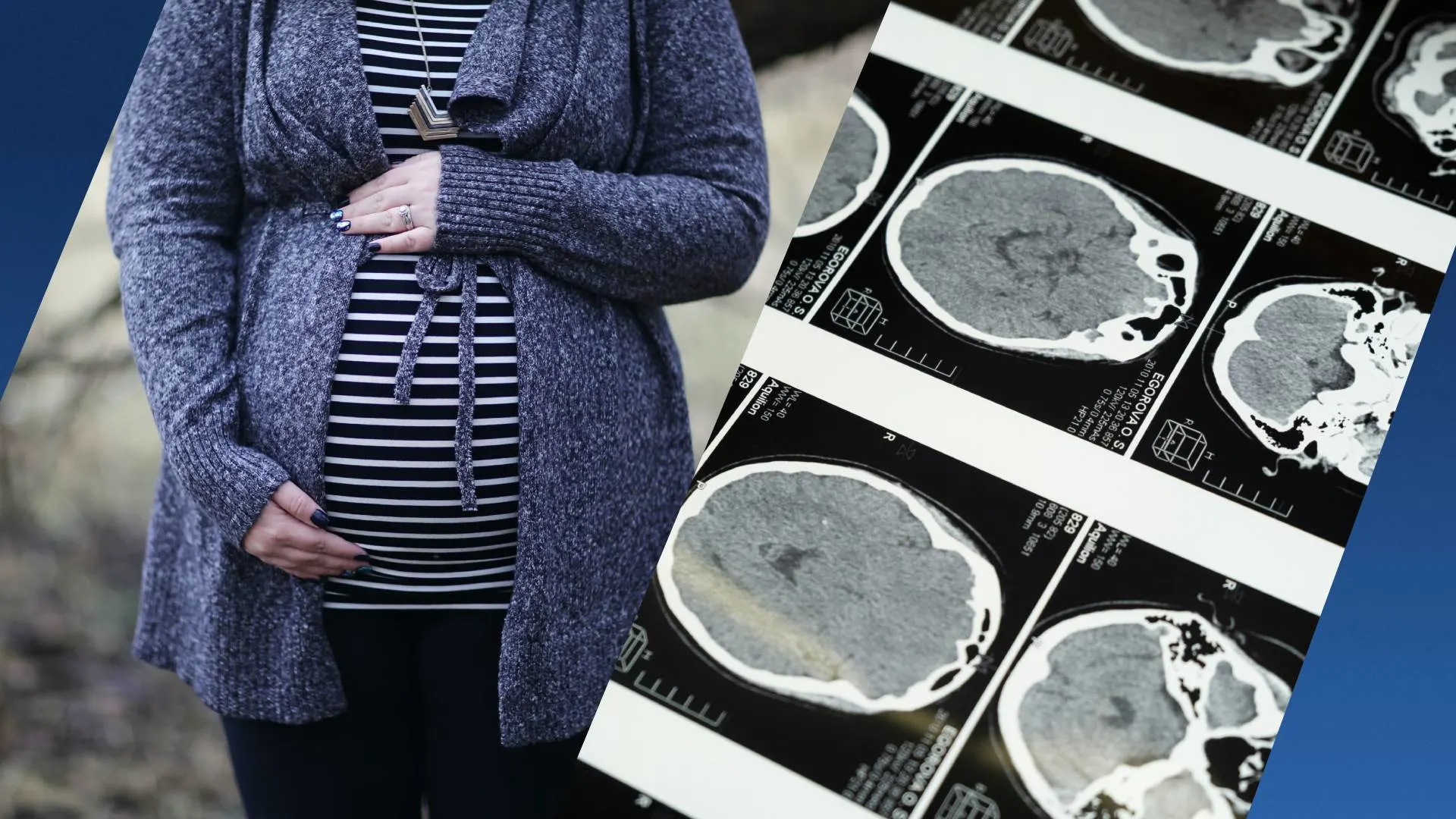 Onderzoek toont aan dat het brein van vrouwen veranderd door zwangerschap