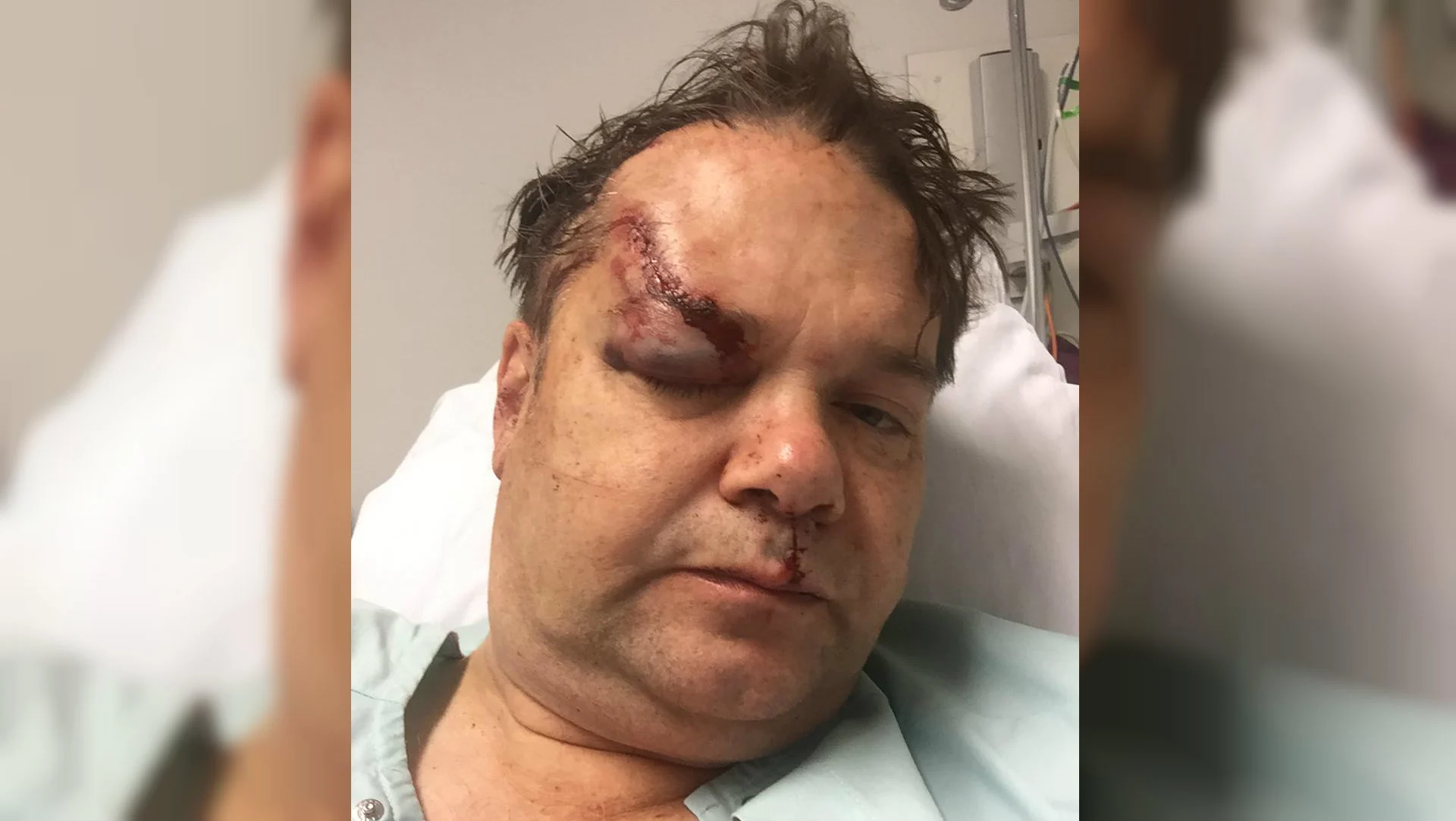 Juwelier met hamer en pistool mishandeld door overvallers: ‘Het bloed spoot uit mijn hoofd’