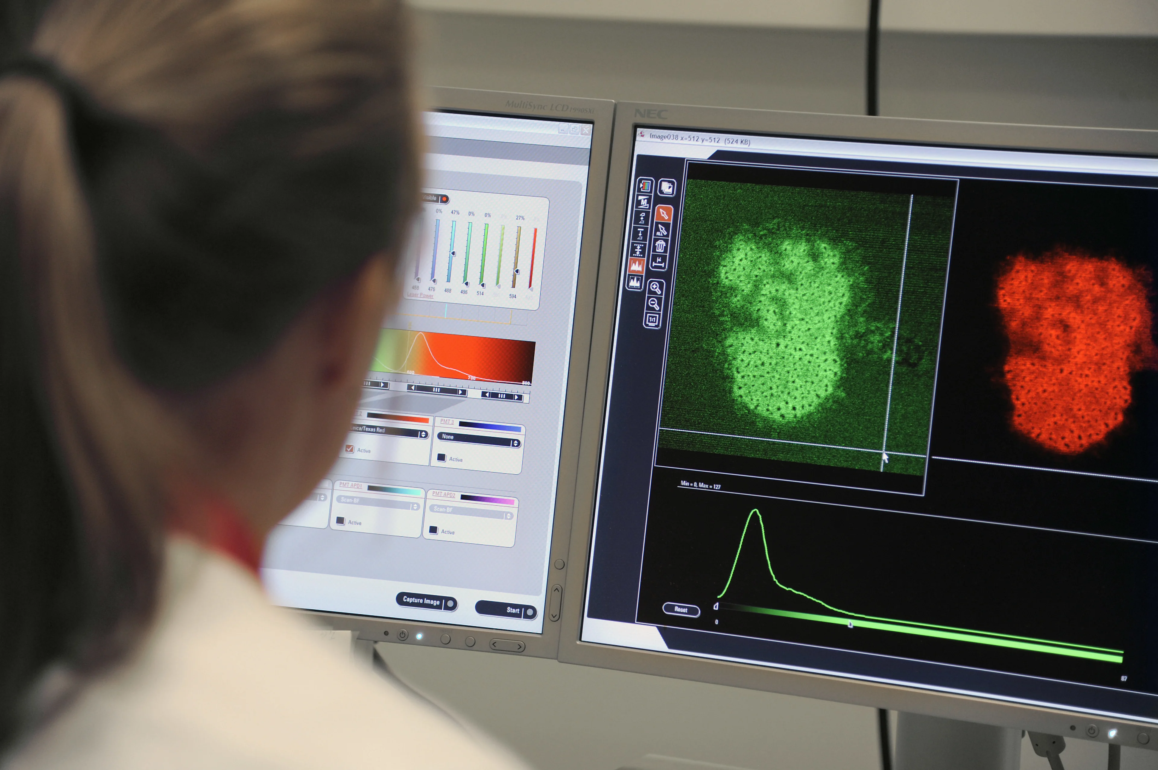 Een op drie patiënten met zeldzame kanker krijgt eerst onjuiste diagnose