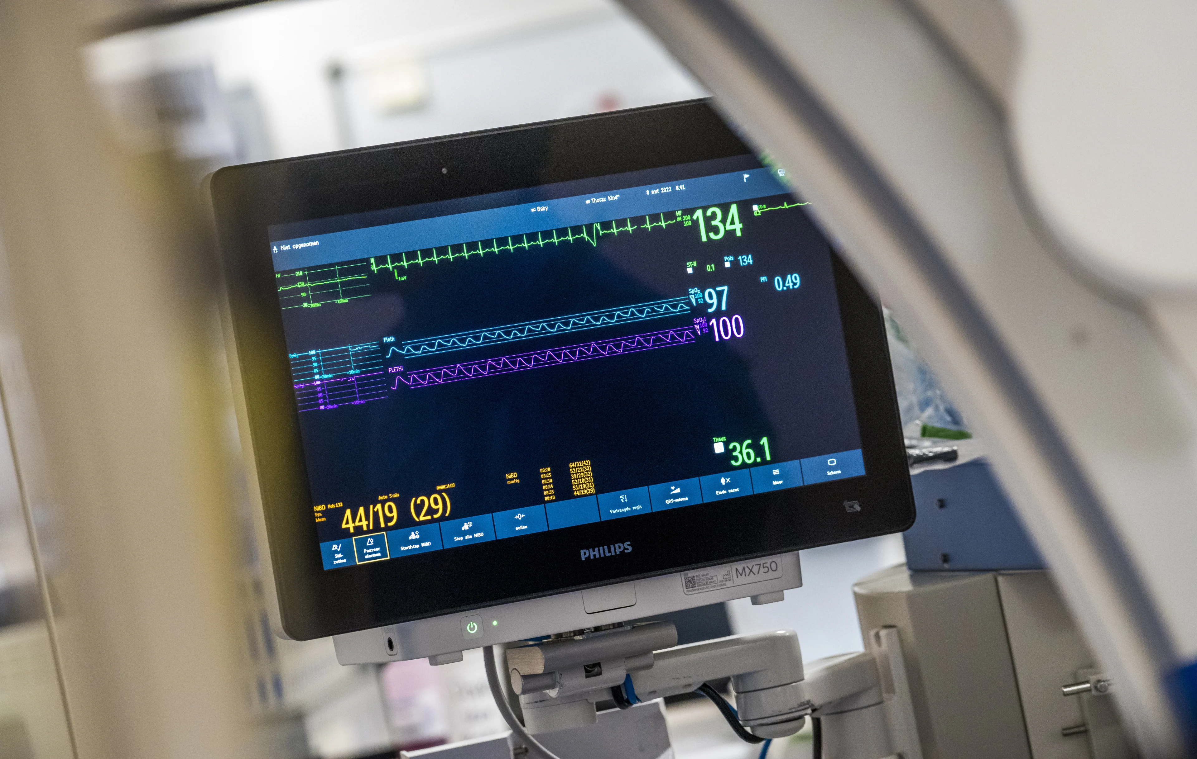 Smartwatches kunnen helpen bij opsporen van hartritmestoornissen