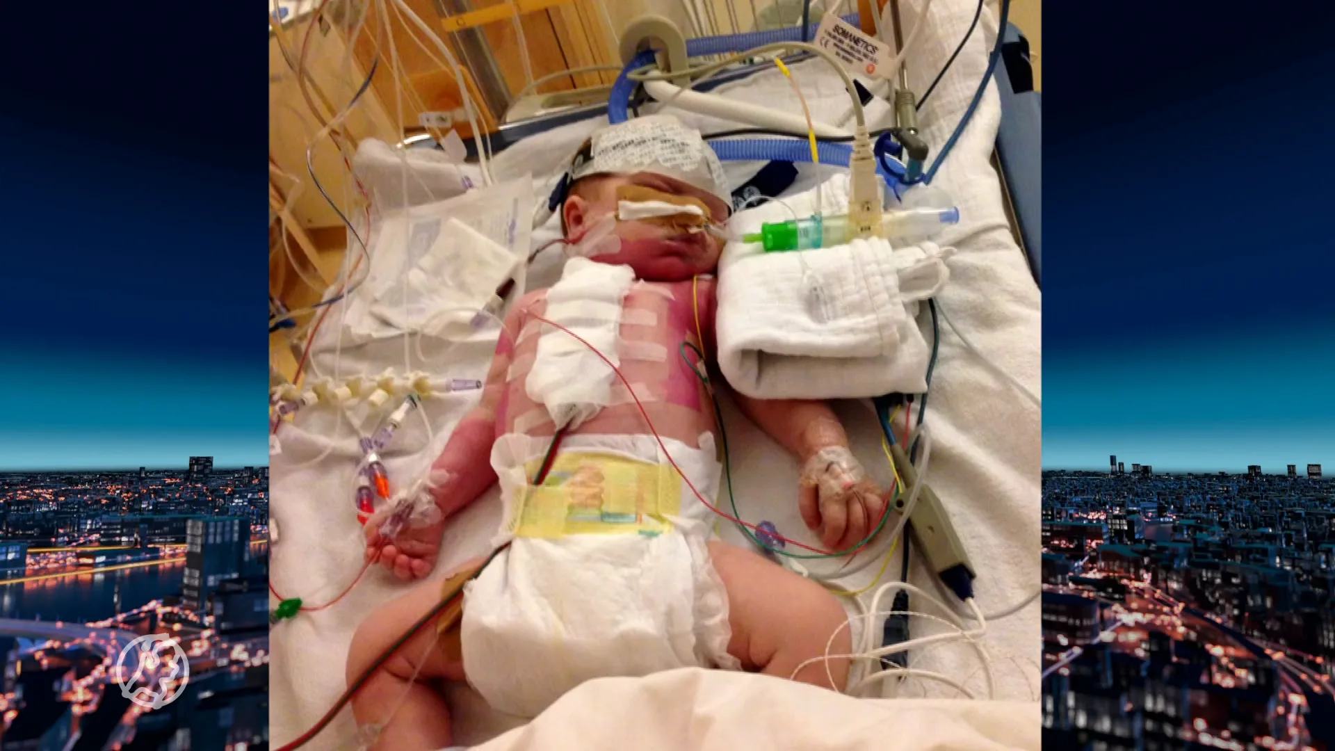 'Ongemakkelijk' gesprek tussen ziekenhuizen over locaties kinderhartcentra: 'Kunnen we er niet bij hebben'