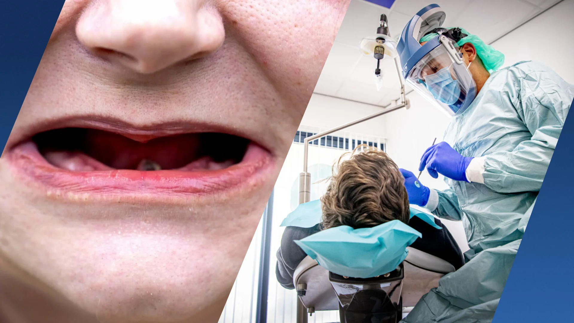 Schrijnend: Jessica (32) laat al haar tanden trekken door geldgebrek