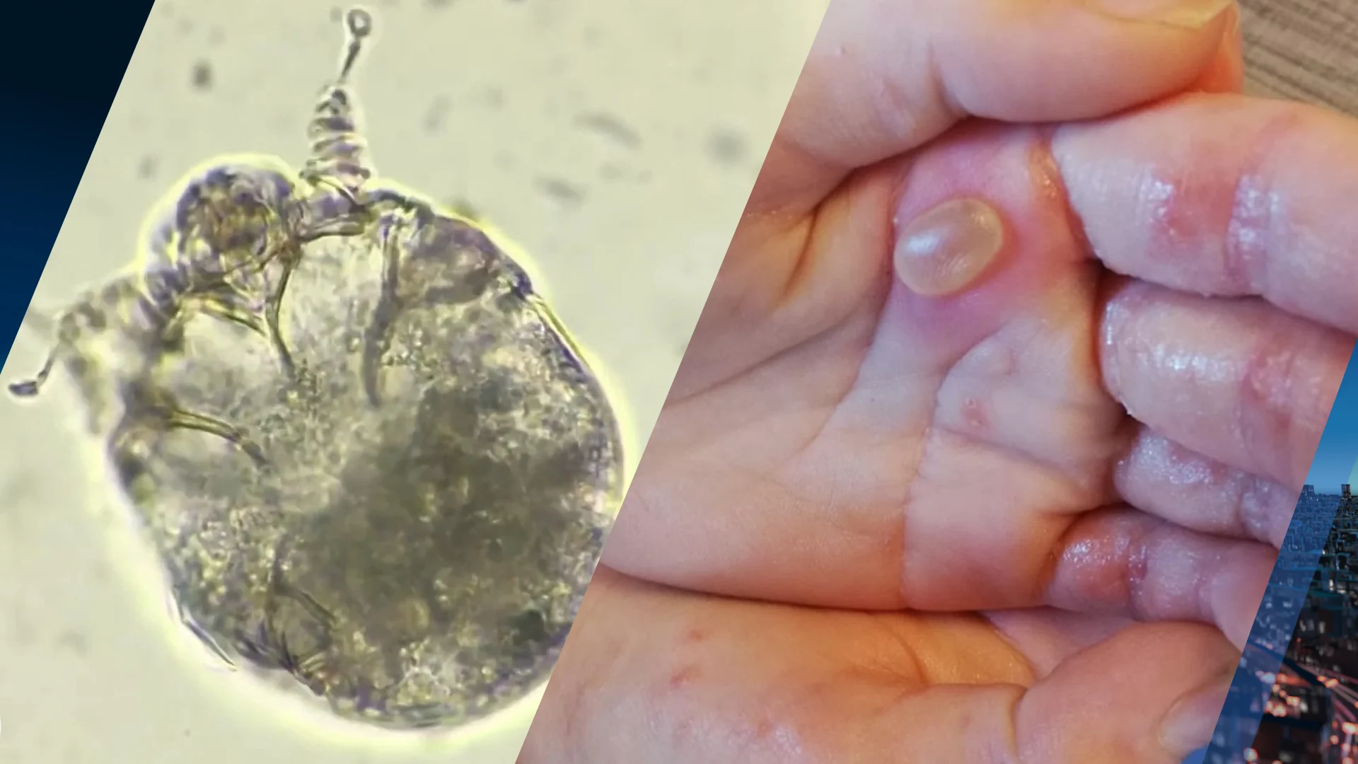 Schurft bezig aan enorme opmars, experts vrezen voor grote uitbraken