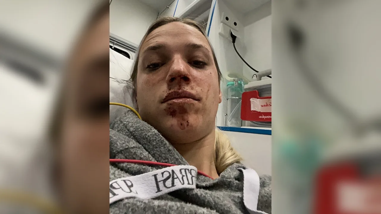 Tahnee (24) slachtoffer van brute woningoverval: vastgebonden en tot bloedens toe in gezicht geslagen