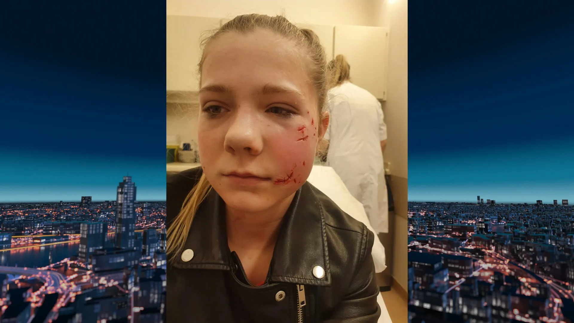 Baasje bijthond moet duizenden euro's betalen aan verminkte Neona (14)