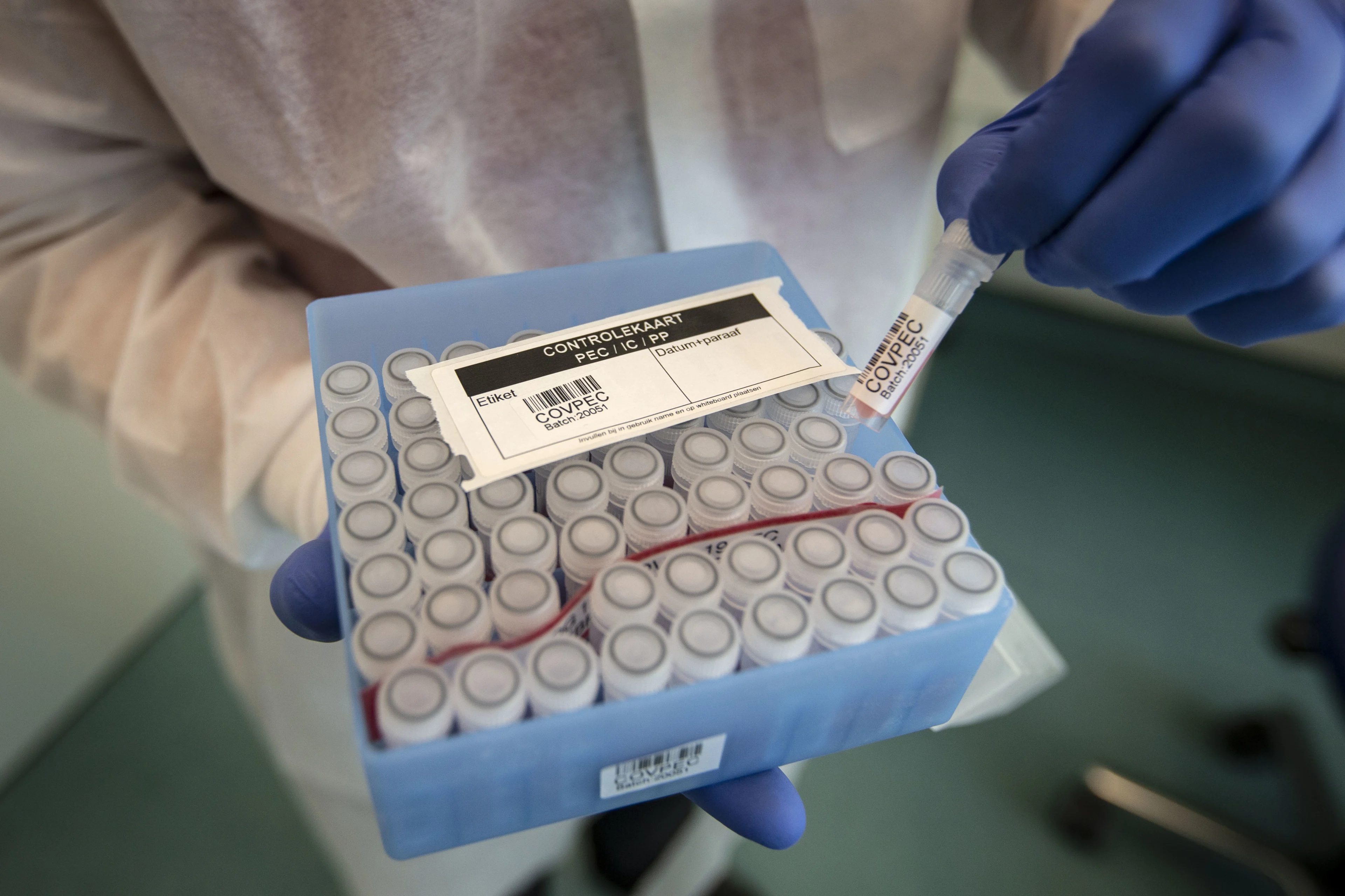 RIVM: 65 nieuwe coronapatiënten opgenomen, dodental stijgt met 43