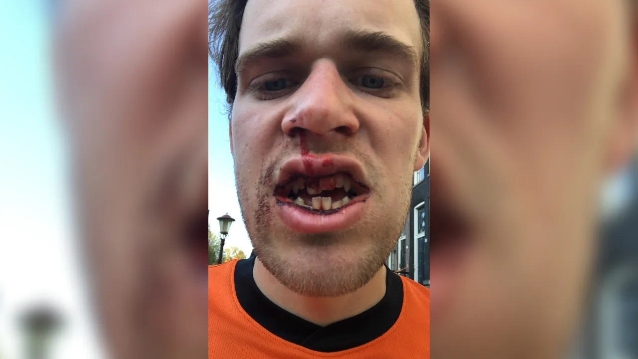 Lars werd tijdens Koningsdag zwaar mishandeld: 'Ongelooflijk dat hij nog leeft' 