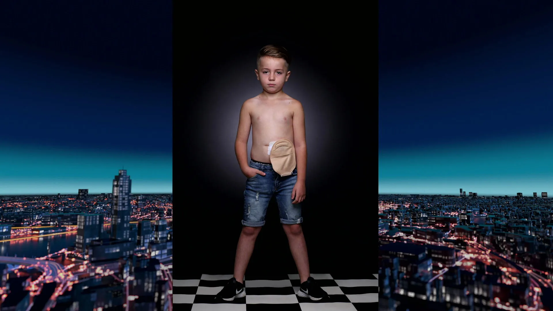 Narik (7) heeft een stoma en schaamt zich er niet langer voor