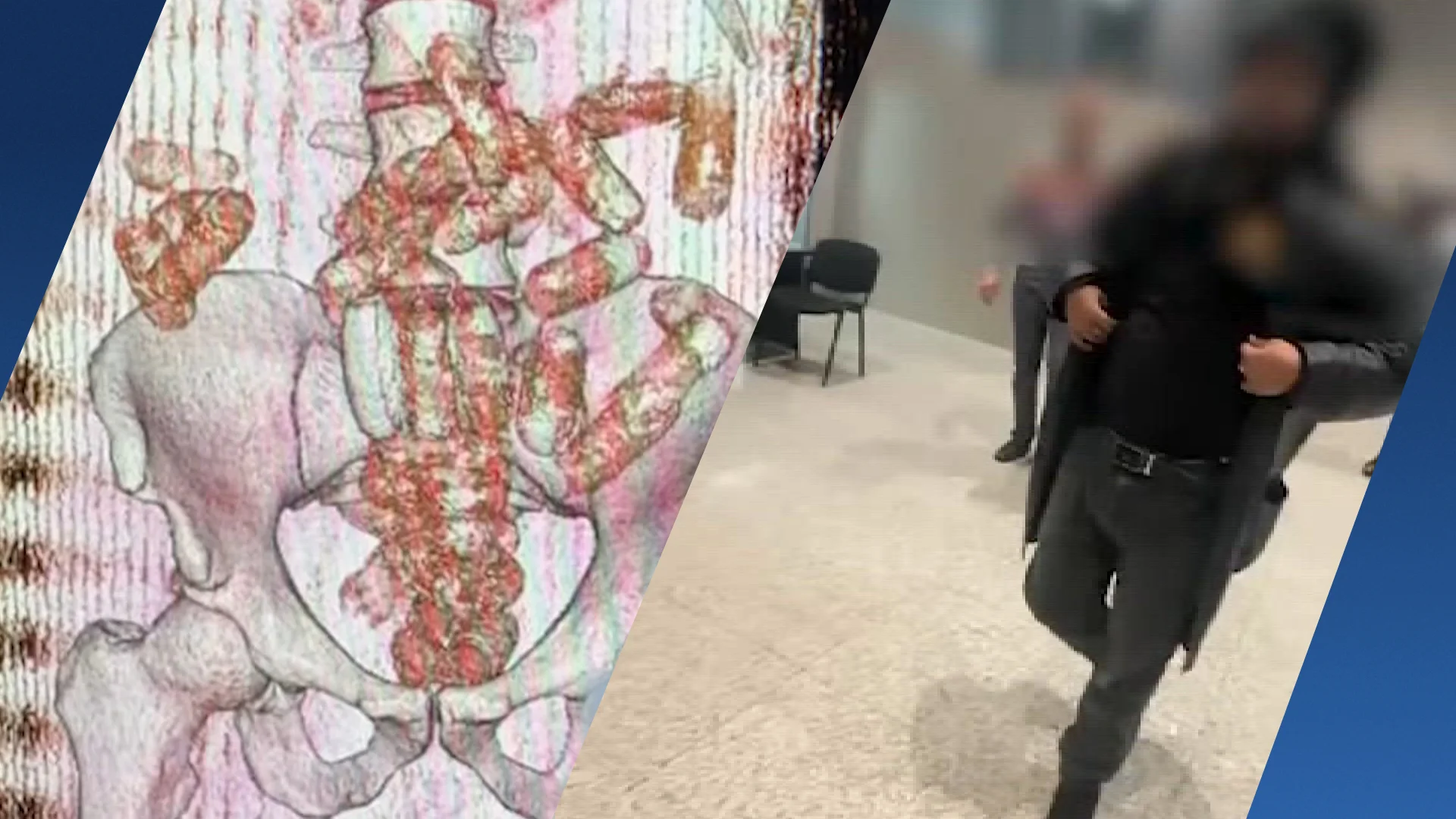 'Nederlander in Armenië gepakt met bijna kilo cocaïne in zijn maag'