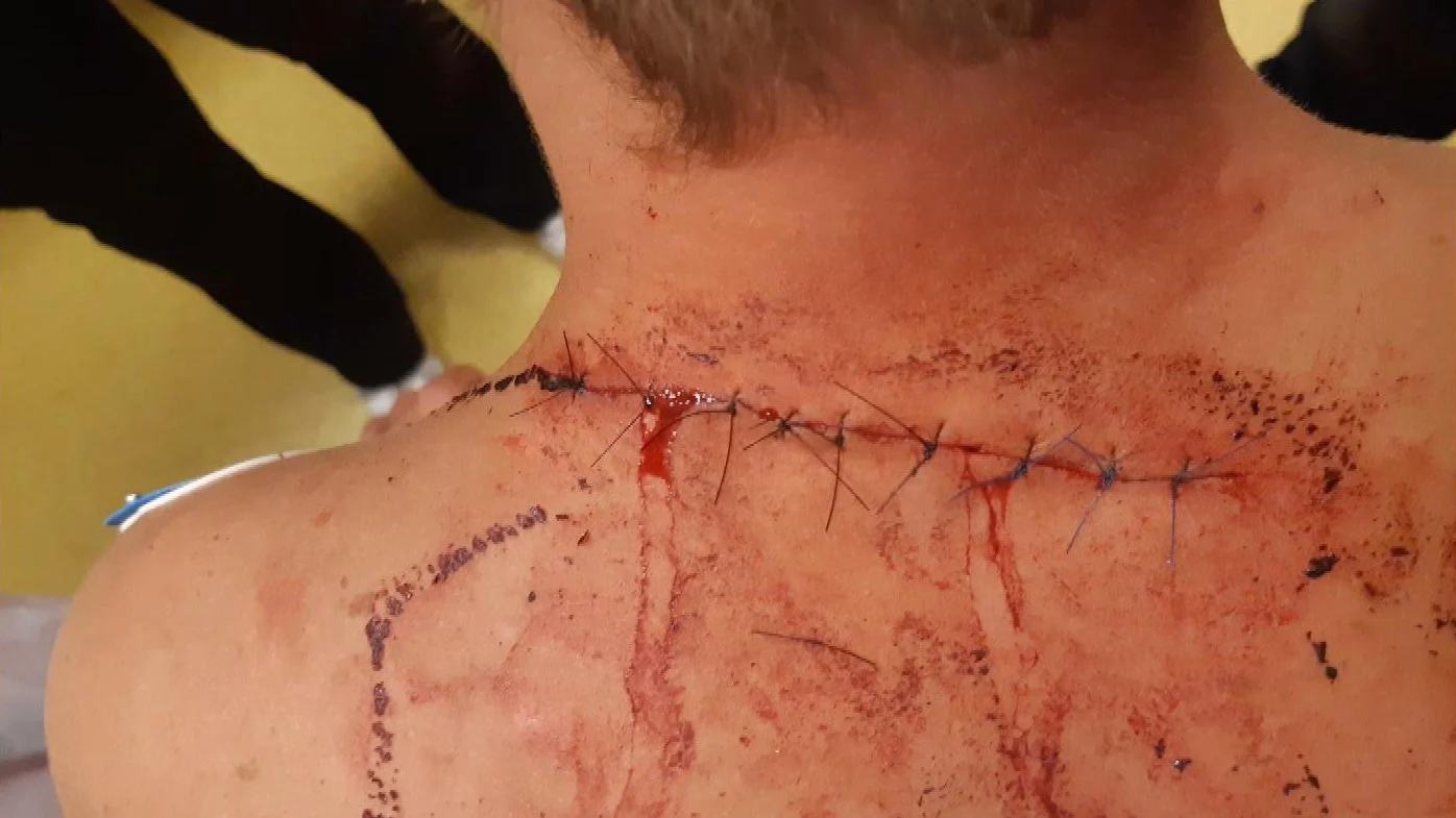 Politie deelt foto's steekpartij op slapende vissers Beekse Bergen en roept op: 'Meiden, meld je'