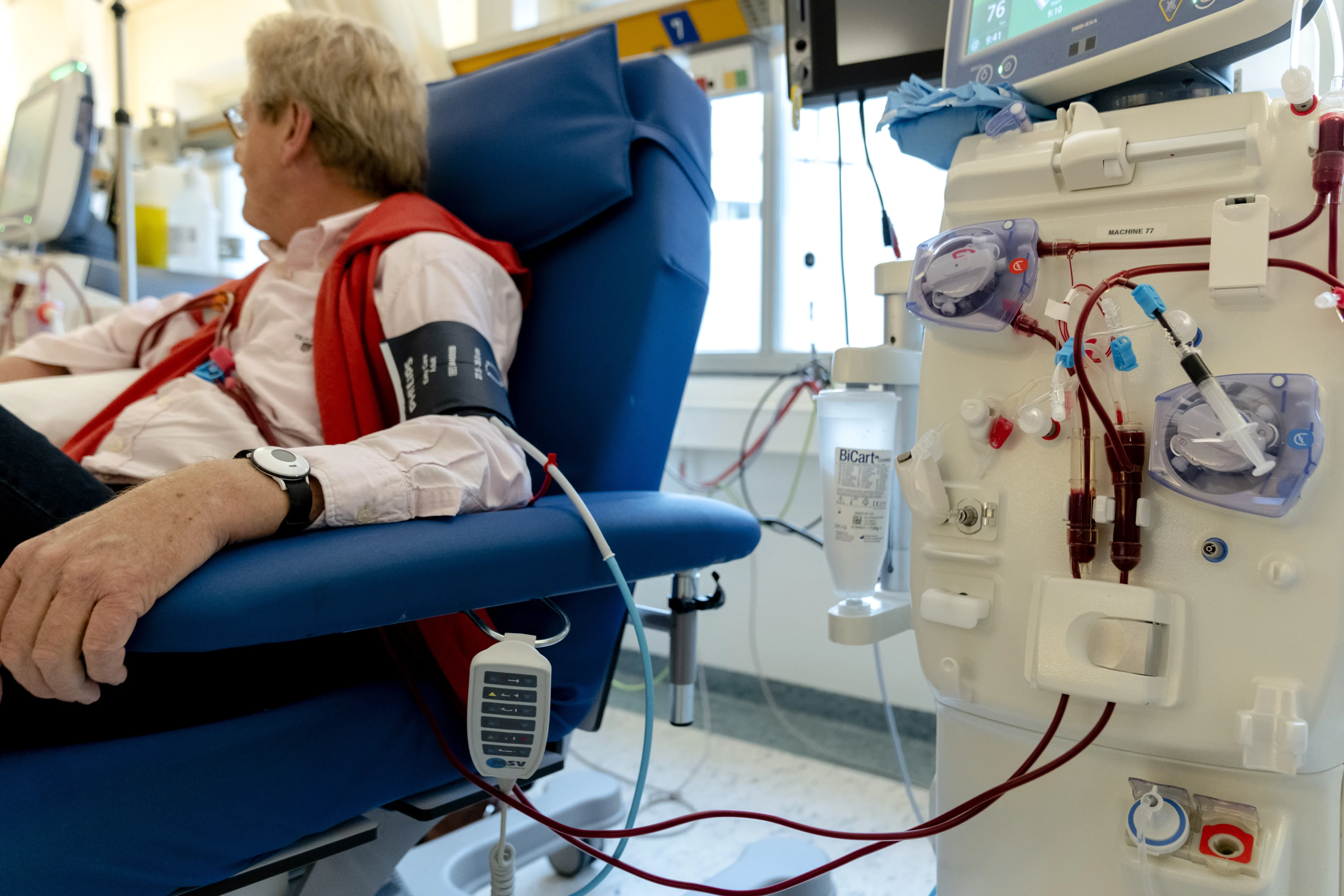 Onderzoekers hoopvol over nieuwe behandeling bij nierfalen: 'Kans op overlijden neemt met 23 procent af'