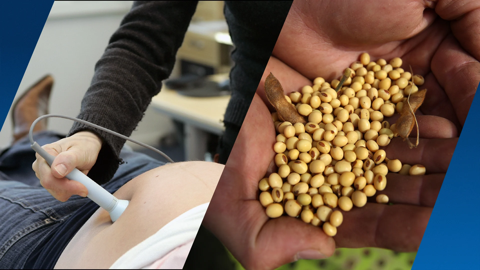 Onvruchtbaar door te veel soja: hoe realistisch is dat?