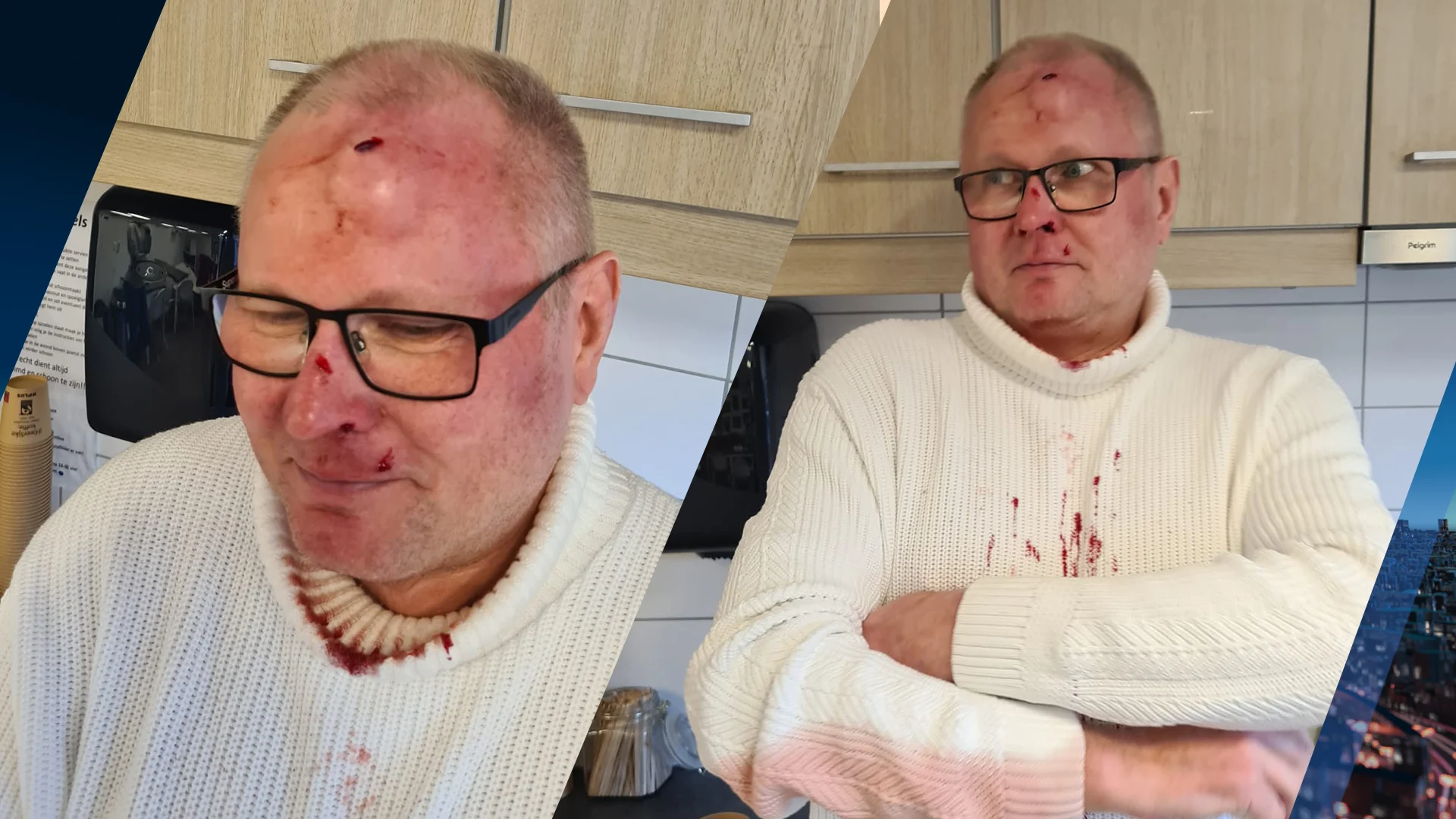 Alwi (59) wilde pak koffie halen, maar werd zwaar toegetakeld