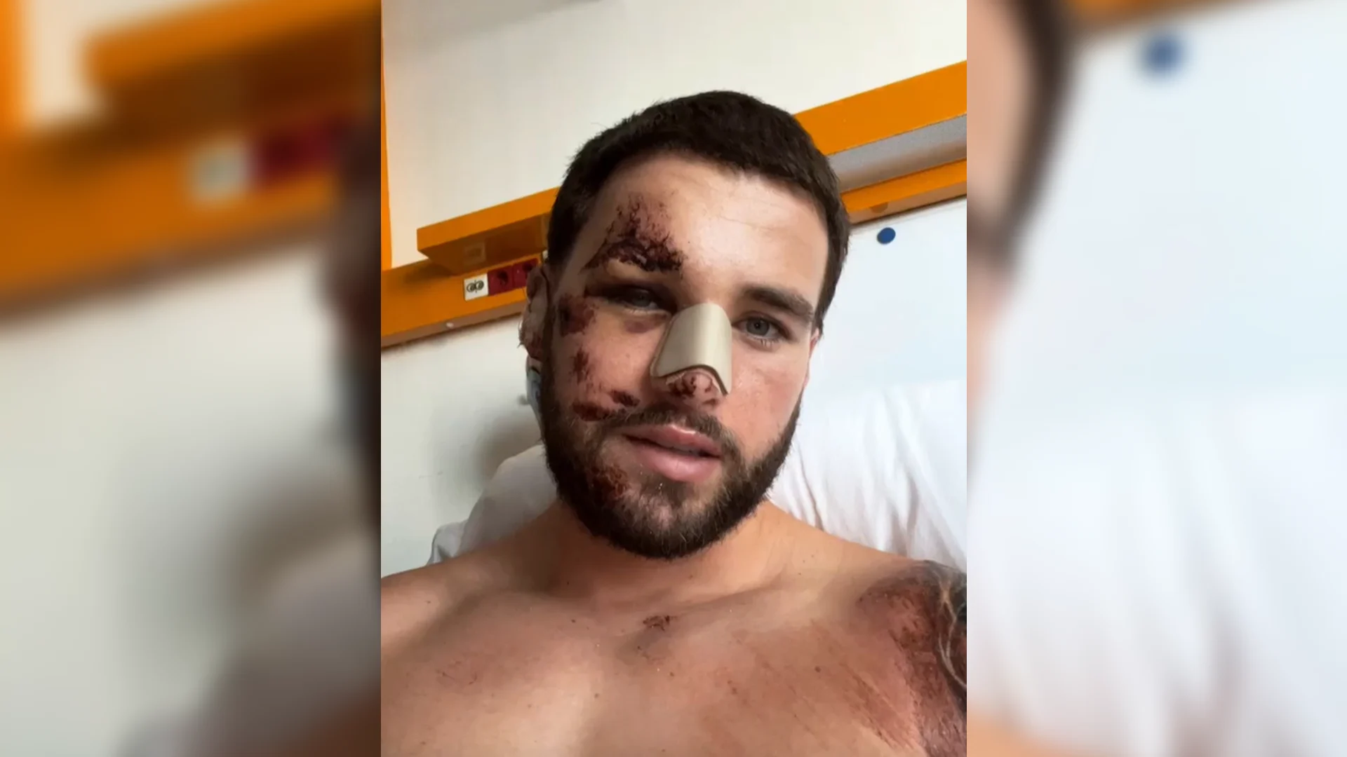 Goed nieuws voor overreden Donny Roelvink