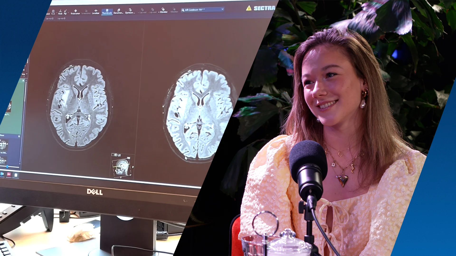 Myrthe (21), die 14 jaar rondliep met hersentumor, ziet 'droomscenario' uitkomen